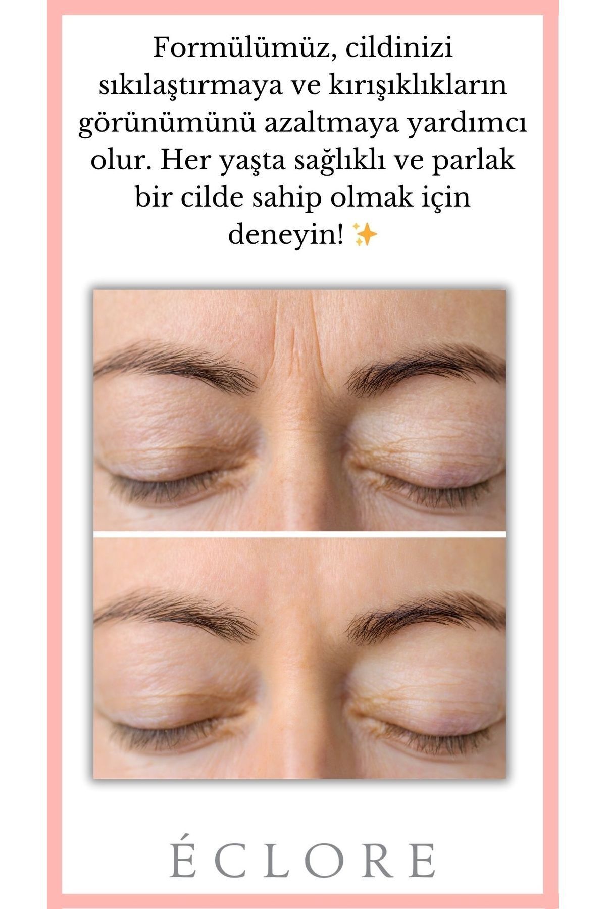 سرم پوست   Eclore | 920410 اورجینال - تصویر 3