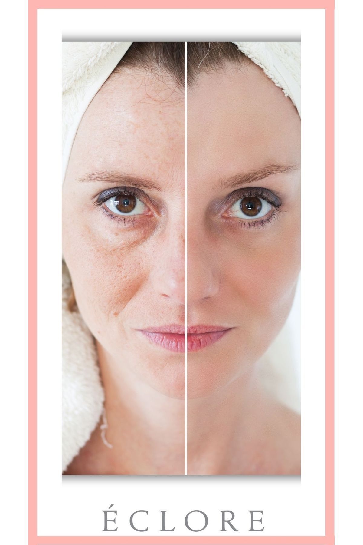 سرم پوست   Eclore | 920410 اورجینال - تصویر 4