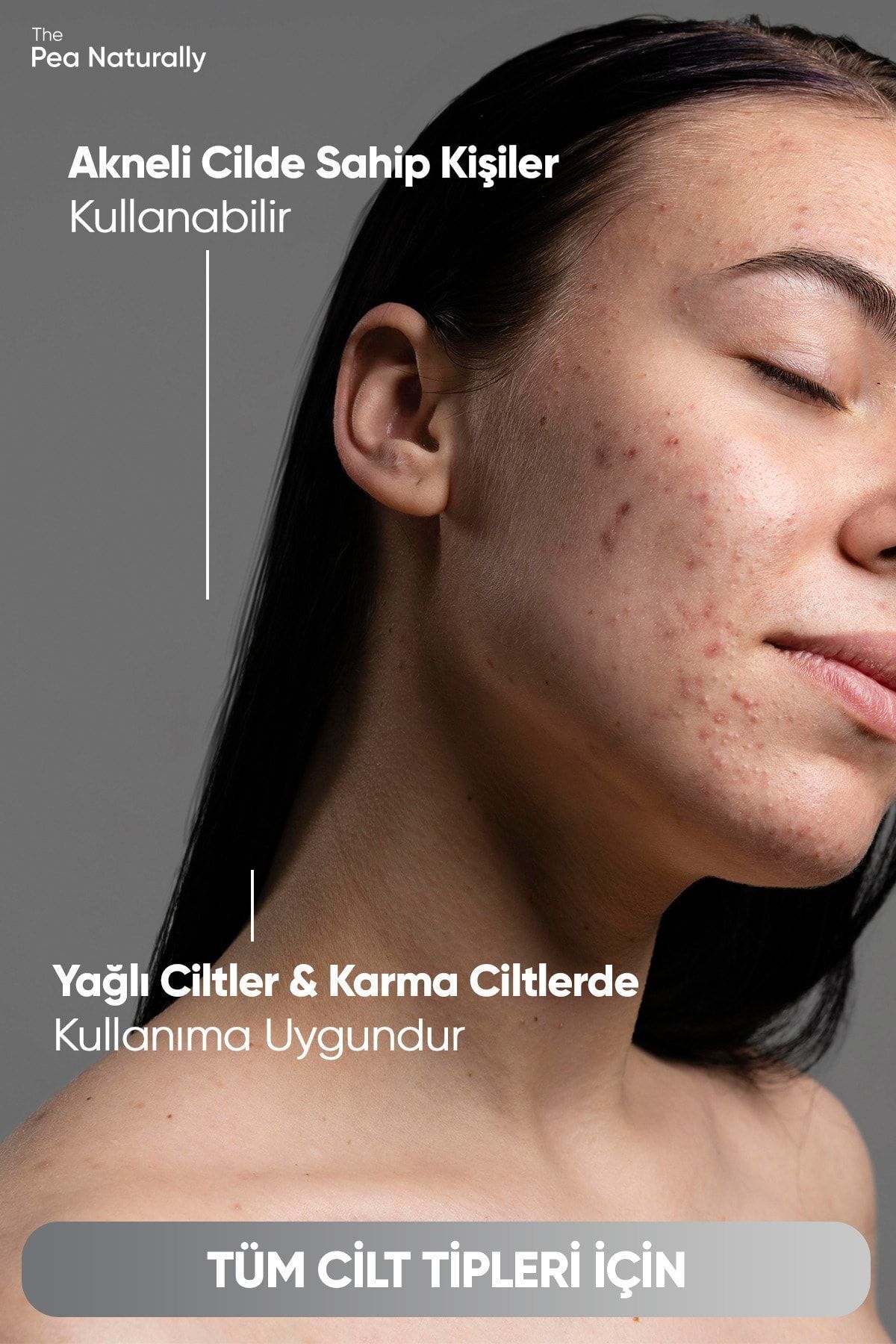 Akne & Siyah Nokta Karşıtı Yüz Temizleme Jeli 200 Ml — PNTRLY05 — تصویر 3 از 9