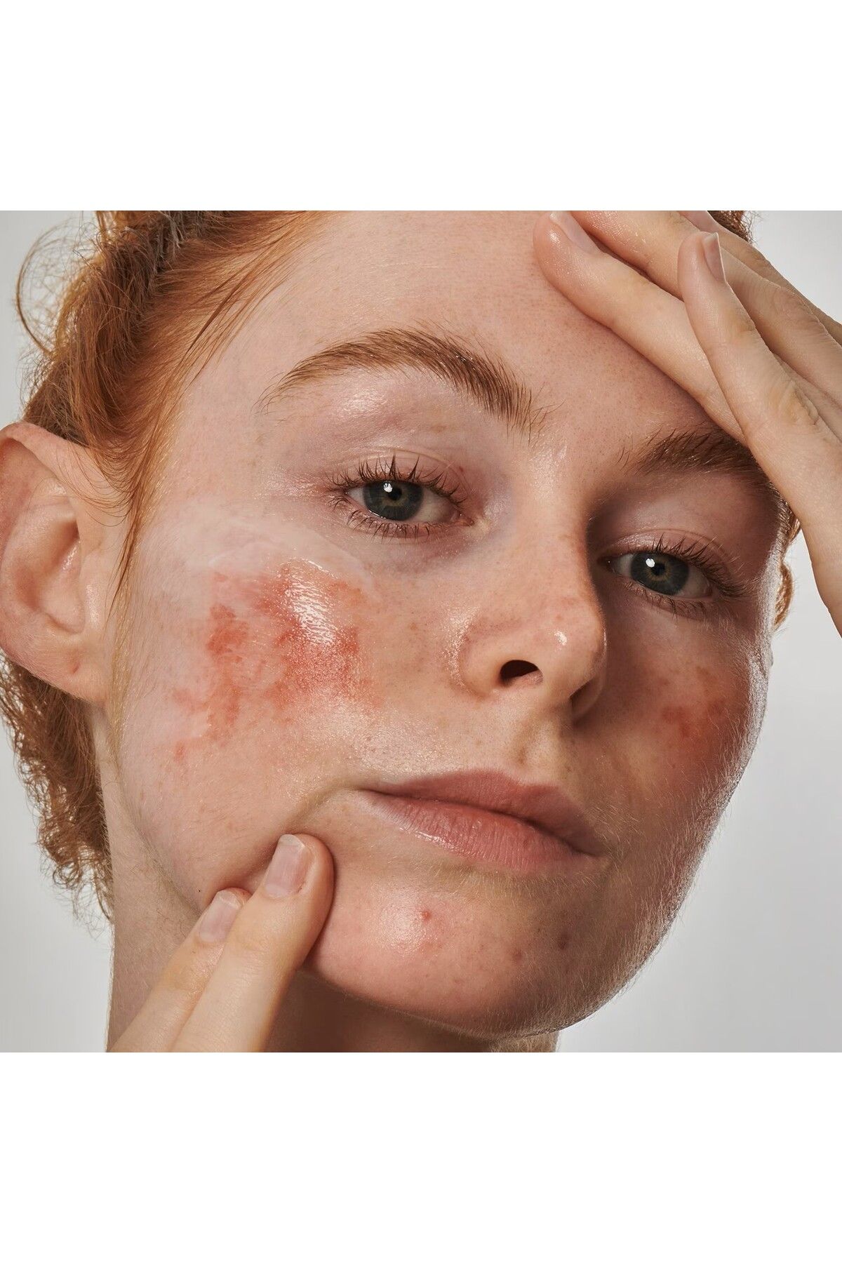 THE INKEY LIST-10% Azelaic Acid Relaxing Redness Serum - 30ML 3
