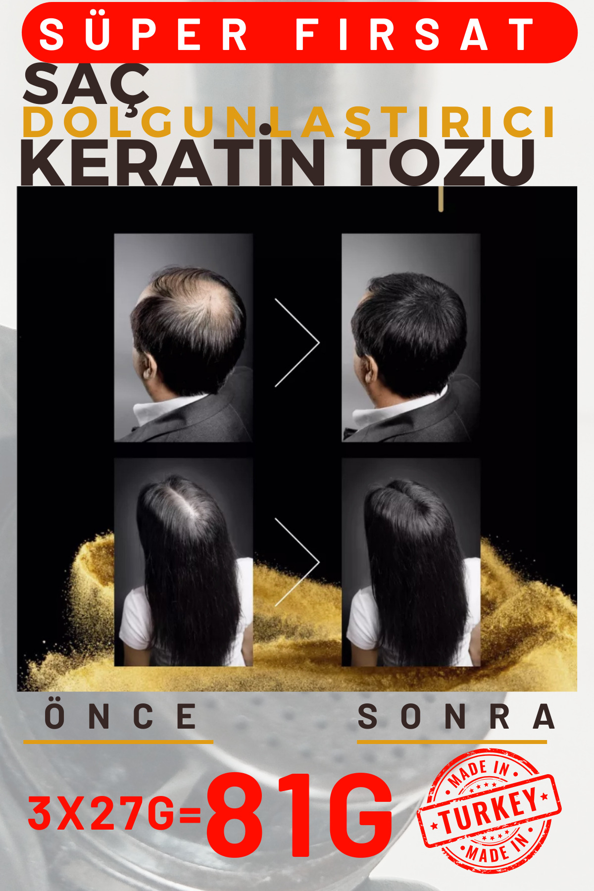81GR SİYAH Saç Dolgunlaştırıcı Keratin Fibers, Topik Saç Tozu, Saç Kapatıcı, Saç Fiber, Berber — مشکی A_04 — تصویر 3 از 8