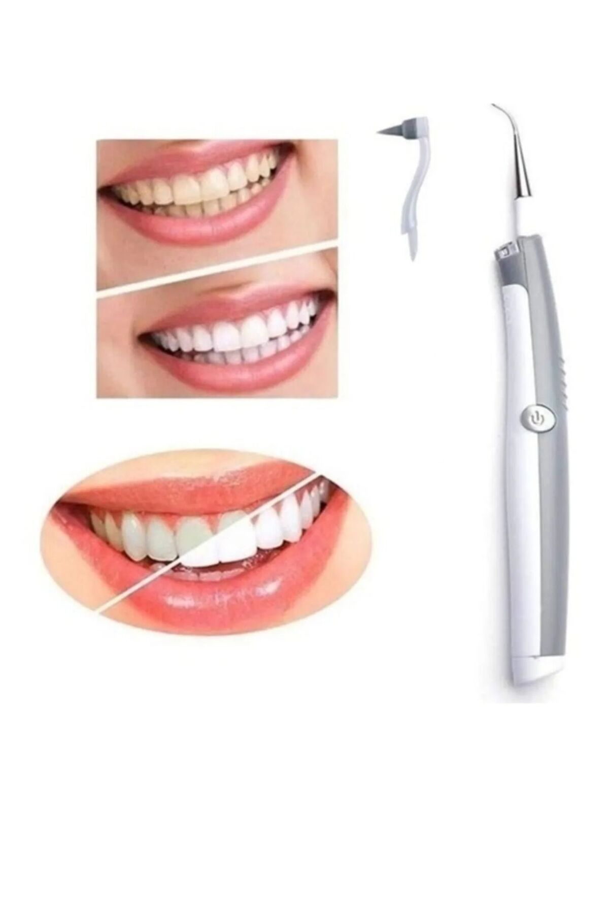 محصولات سفیدکننده دندان SONIC PIC SOFT ULTRASONIC DENTAL TARTAR PLATO CALEING HONE UPEKA