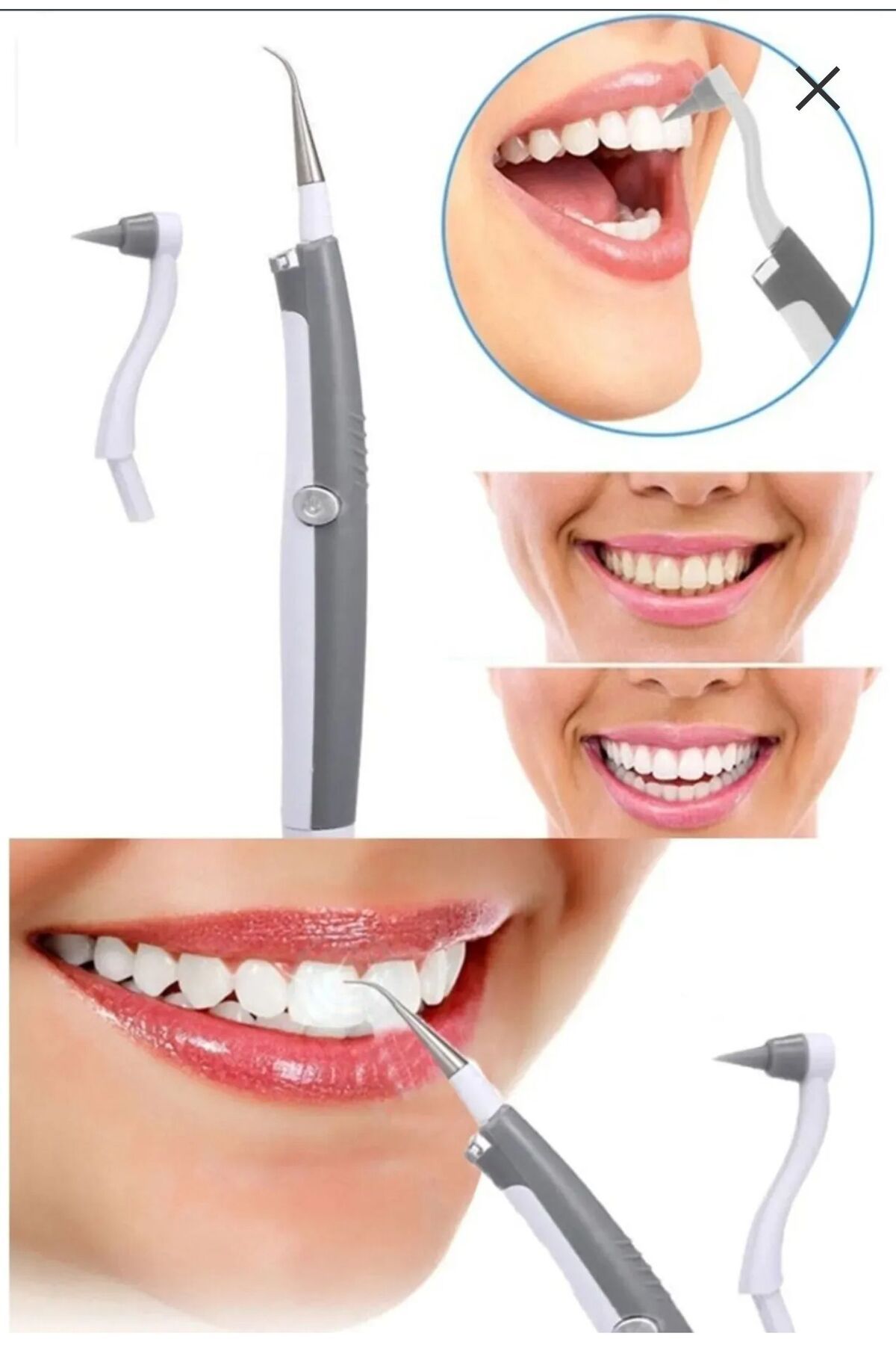 محصولات سفیدکننده دندان SONIC PIC SOFT ULTRASONIC DENTAL TARTAR PLATO CALEING HONE UPEKA