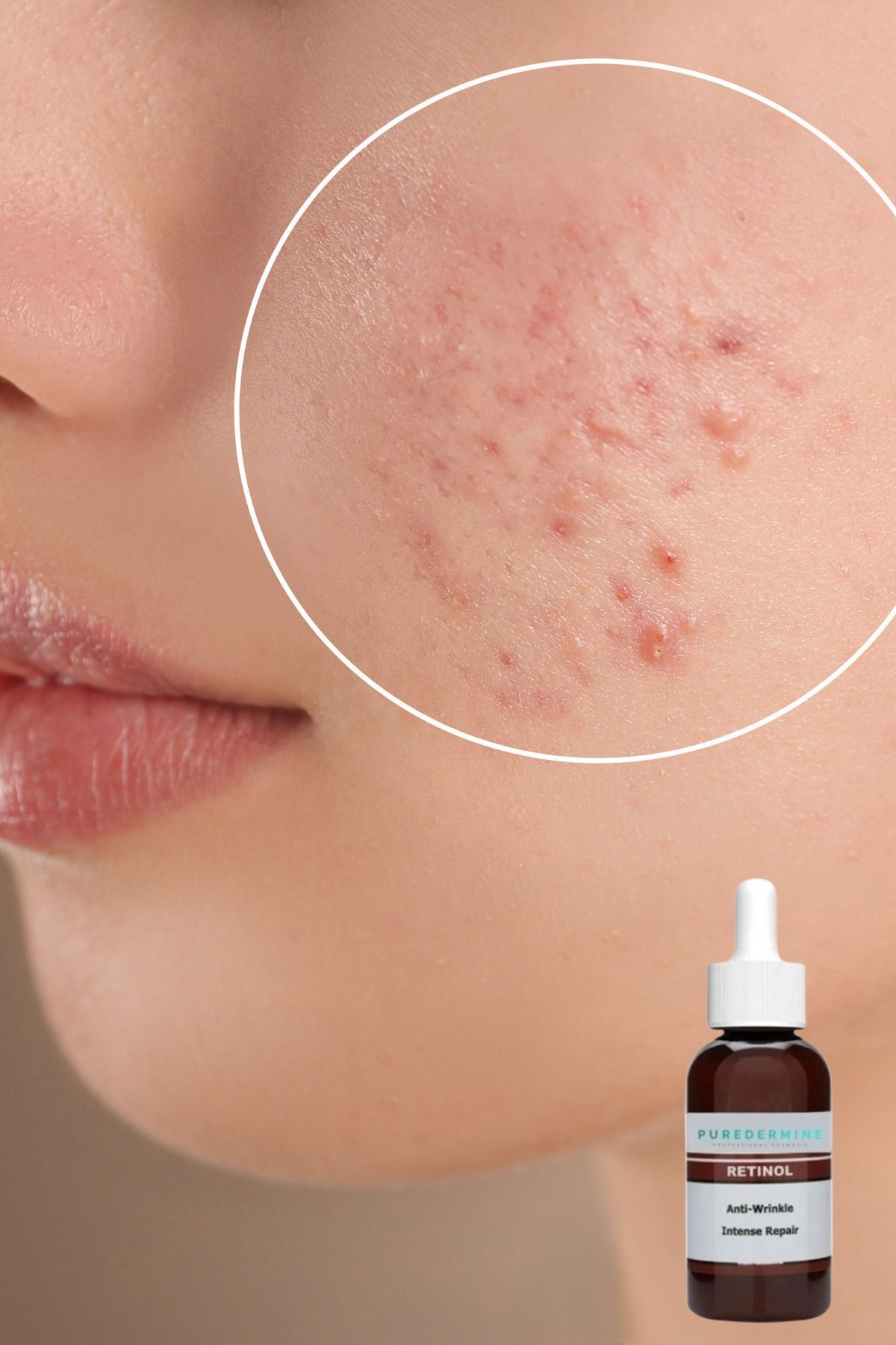 Puredermine-50 ml Retinol 2.5% Large Size Face Serum - Crepe Removal, Dark Spots and Fine Lines 2