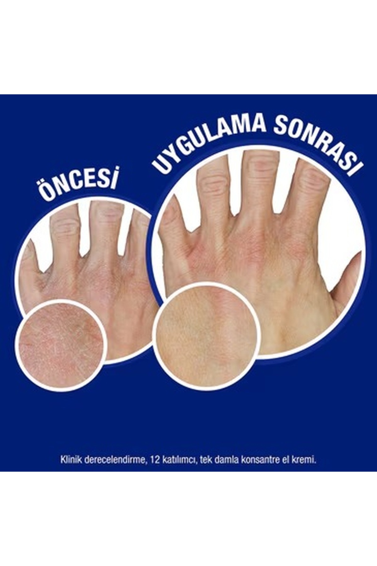 کرم دست   Neutrogena | ADAMER000265 اورجینال - تصویر 4