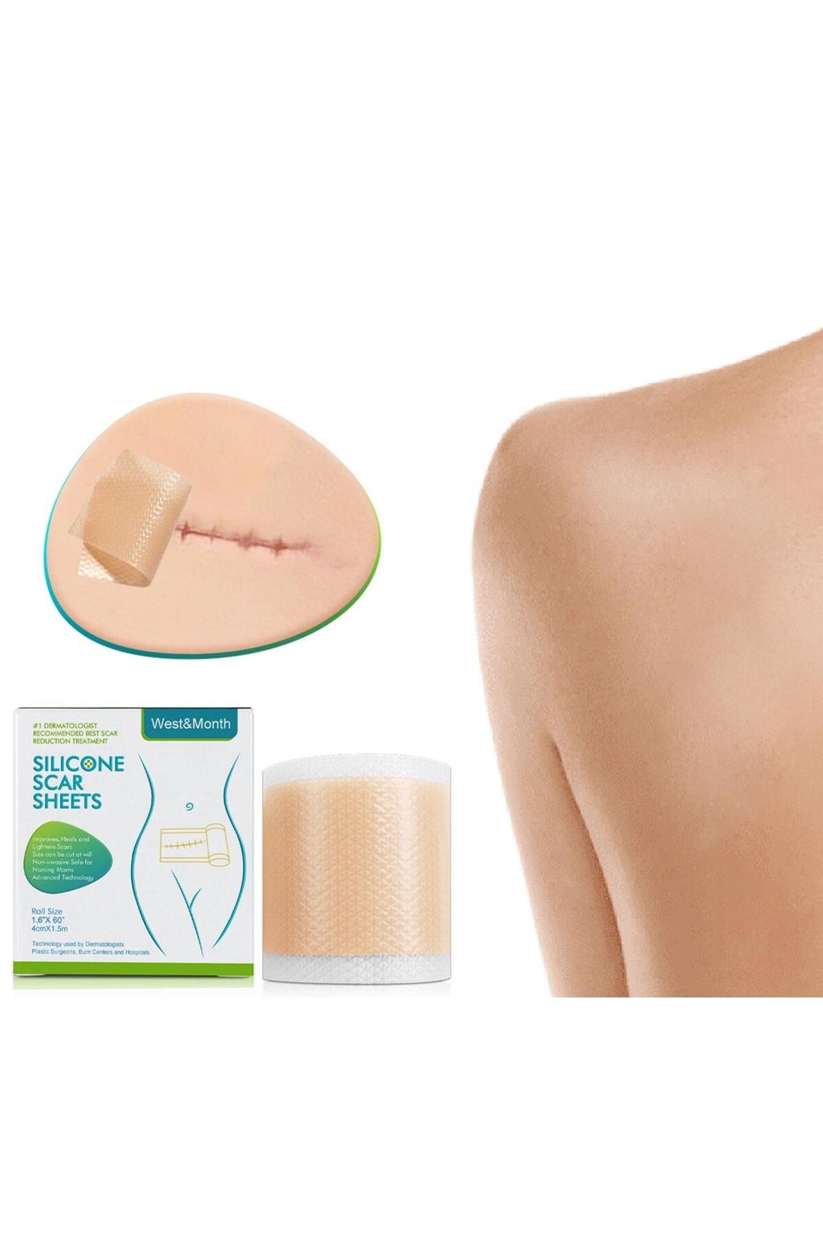 Mustesna Aesthetic Band Aid Burn Acne Surgical Band 4 x 150cm Stretch Medical Silicone Trendyol