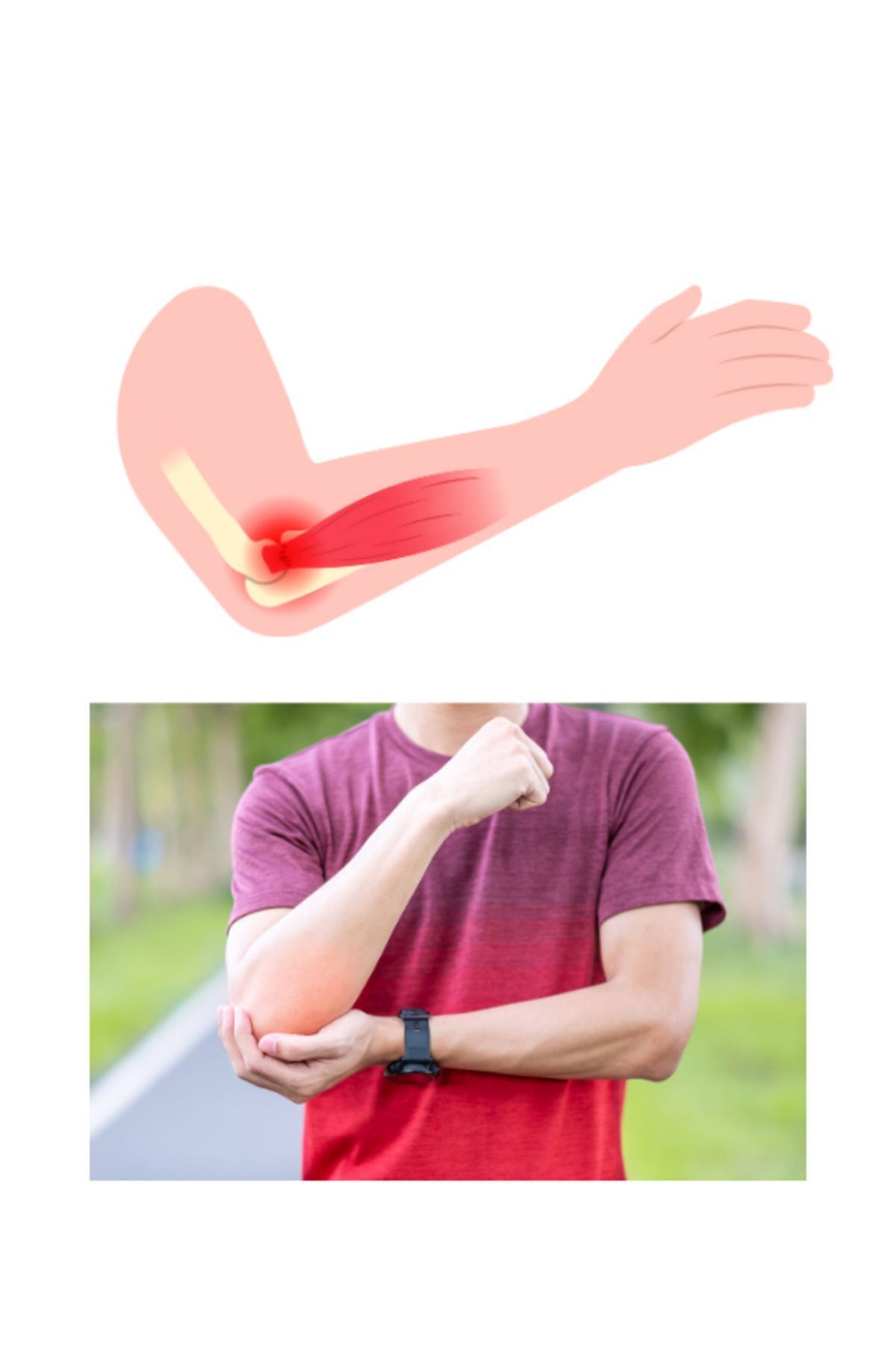 Tenisçi Dirseği Epikondilit Bandı Bandajı Standart Epicondilit Bandajı Ekonomik 3