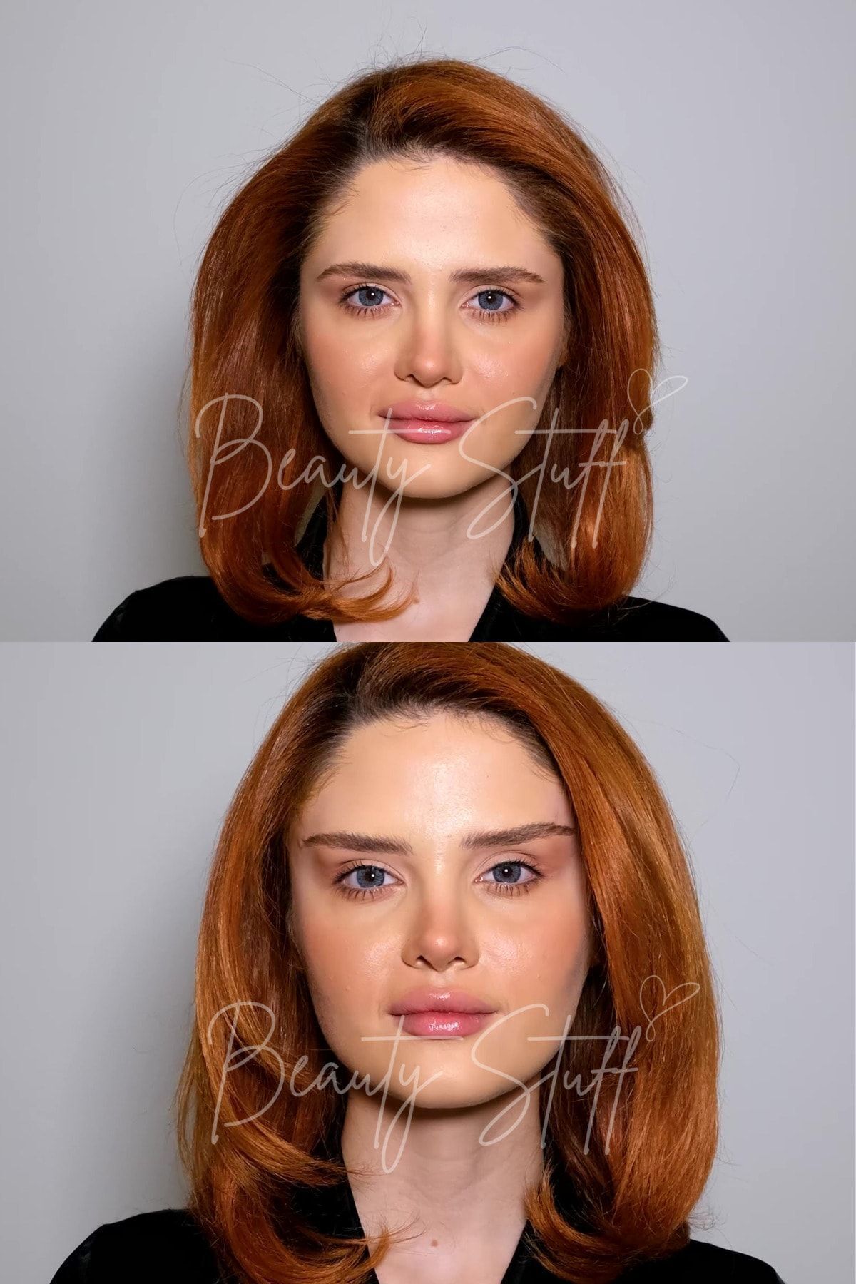 BEJ LASTIKLI Lift Em Up Yüz & Göz Germe Bantları (20li paket) (Made in USA)