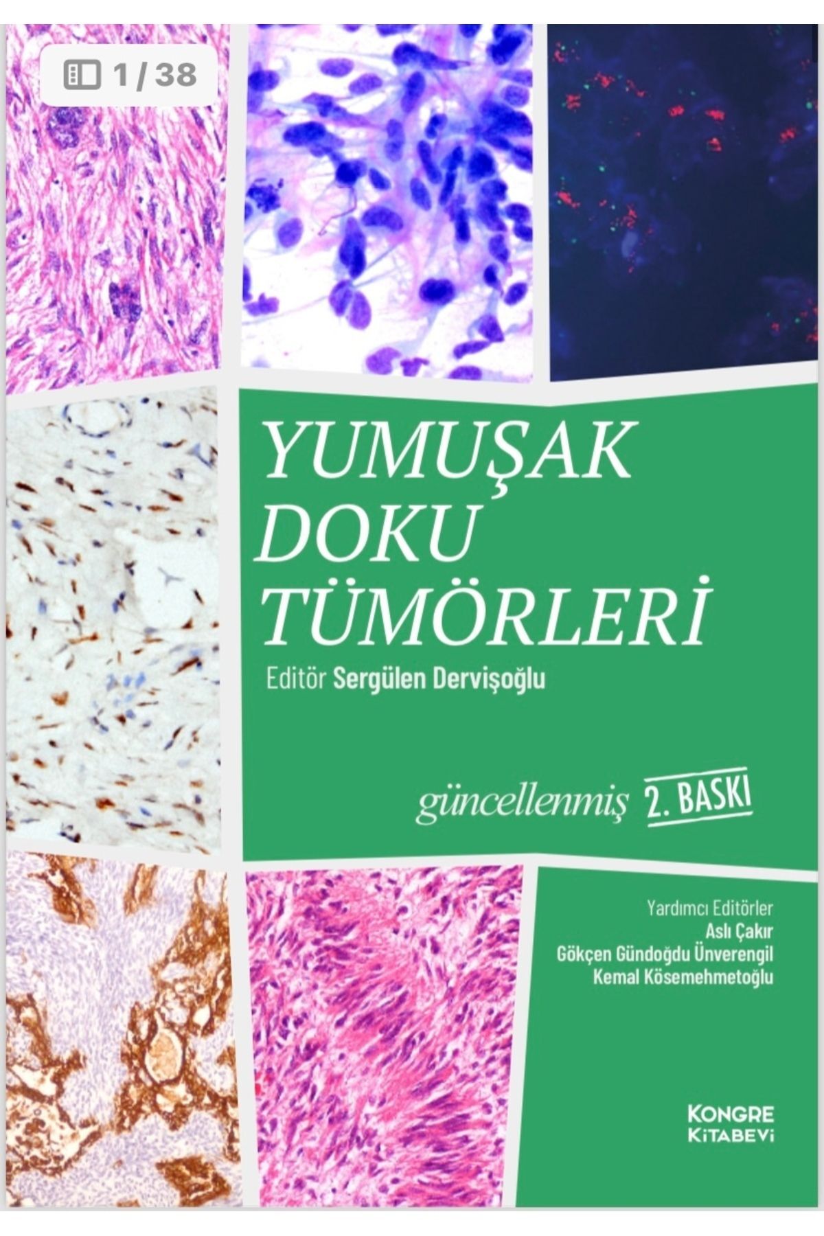 Kongre Kitabevi Yumuşak Doku Tümörleri 2.Baskı