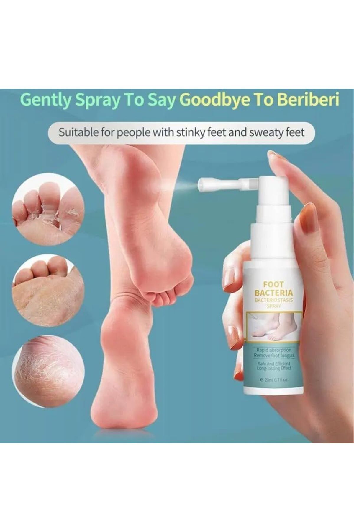 DubaiGallery-20 ml Foot Fungus Spray, Athlete's Foot Spray, Antibacterial Foot Spray, Antifungal Foot Spray 3
