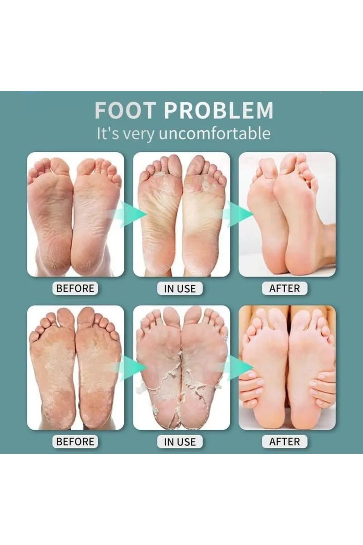 DubaiGallery-20 ml Foot Fungus Spray, Athlete's Foot Spray, Antibacterial Foot Spray, Antifungal Foot Spray 4