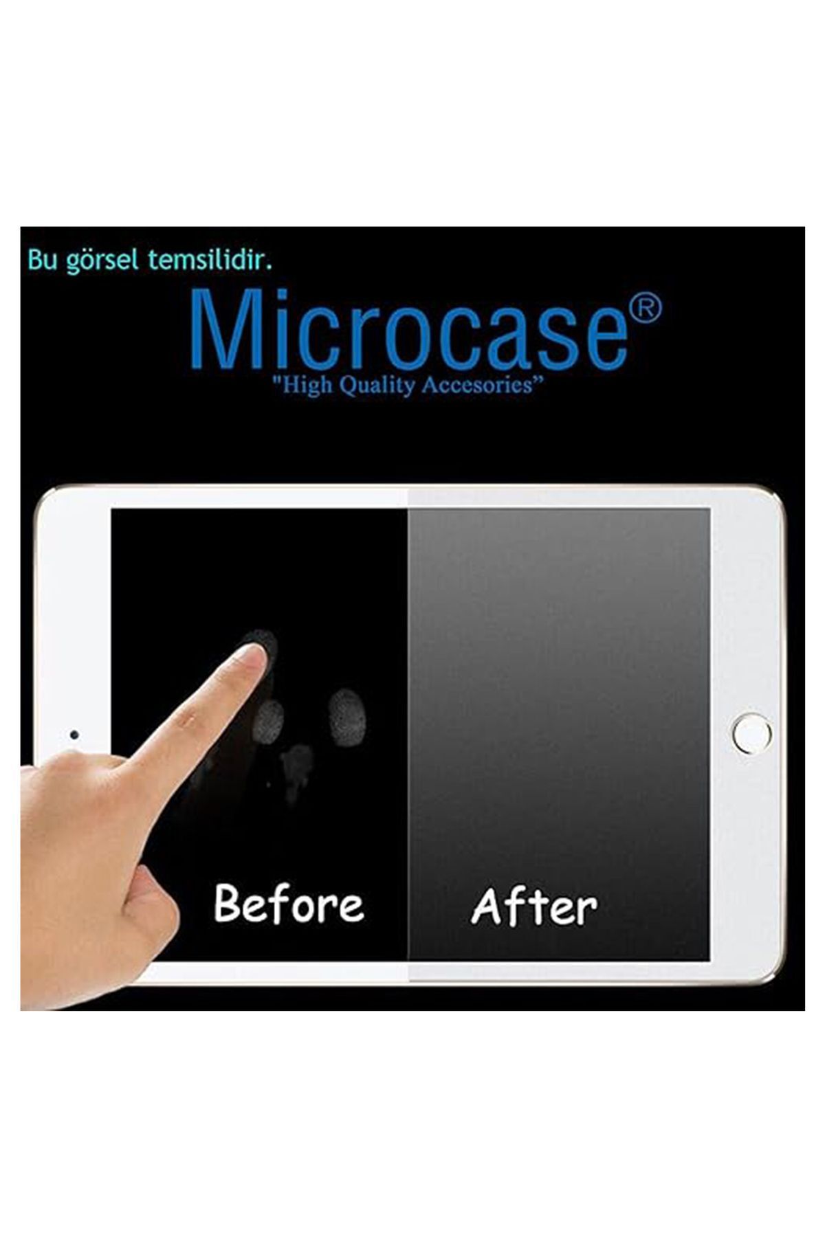 Microcase-Lenovo Tab K11 - تابلت نانو 11 بوصة، طبقة حماية مرنة ومضادة للتوهج - AL3288 4