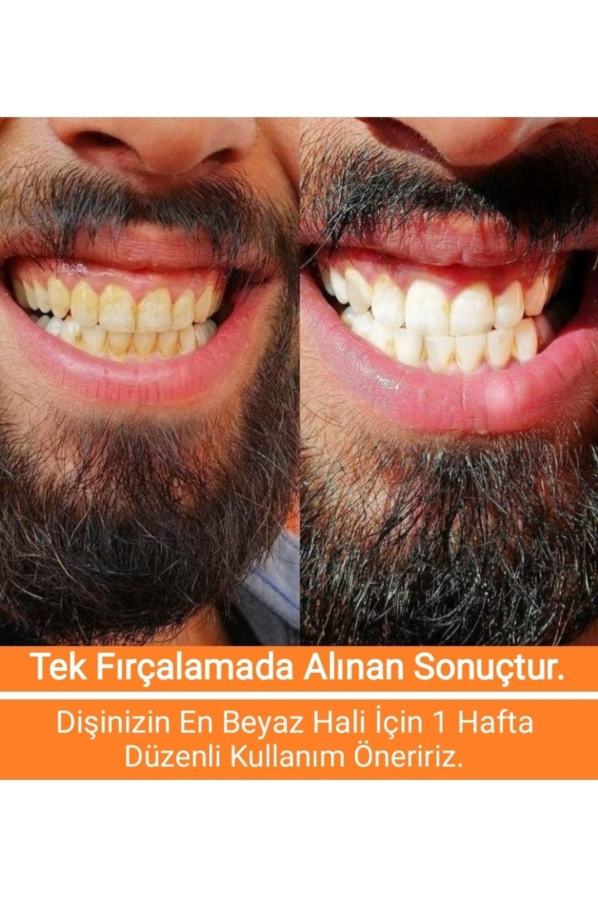 محصولات سفیدکننده دندان کرم سفید کننده و صیقل دادن 80 گرم. Diamond Dental