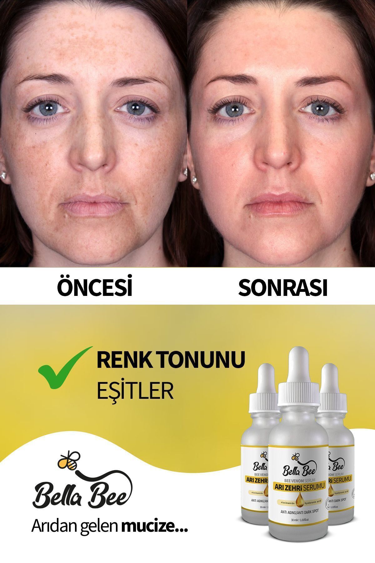 سرم پوست   BELLA BEE | BELLA-02 اورجینال - تصویر 2