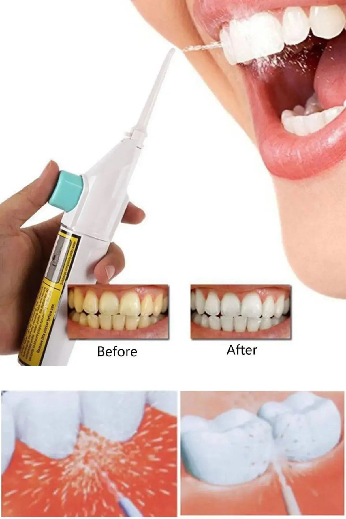 محصولات سفیدکننده دندان POWER FLOSS TOOT SHOWER MACHINE MAINTAINMENT CLEANING JET SPRAY CLEANER qualityworld