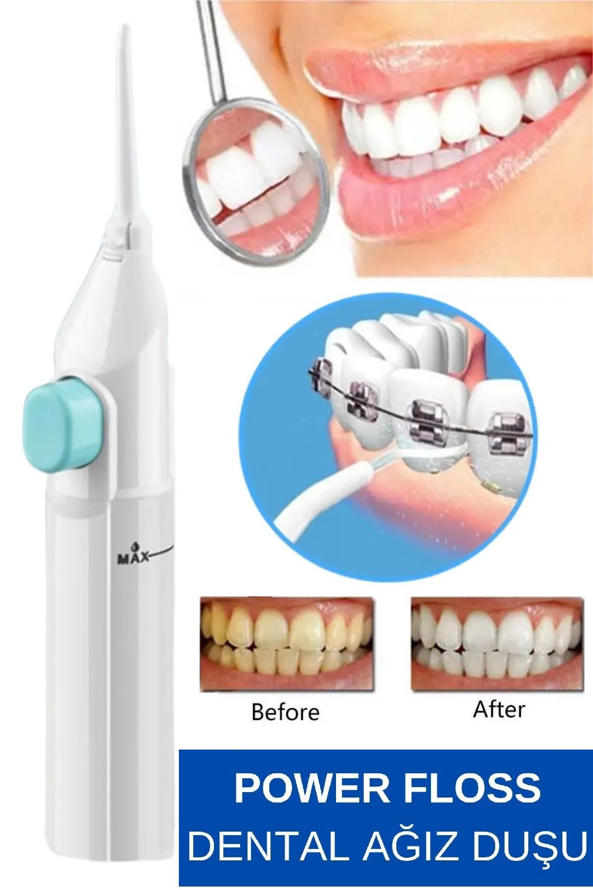 محصولات سفیدکننده دندان POWER FLOSS TOOT SHOWER MACHINE MAINTAINMENT CLEANING JET SPRAY CLEANER qualityworld
