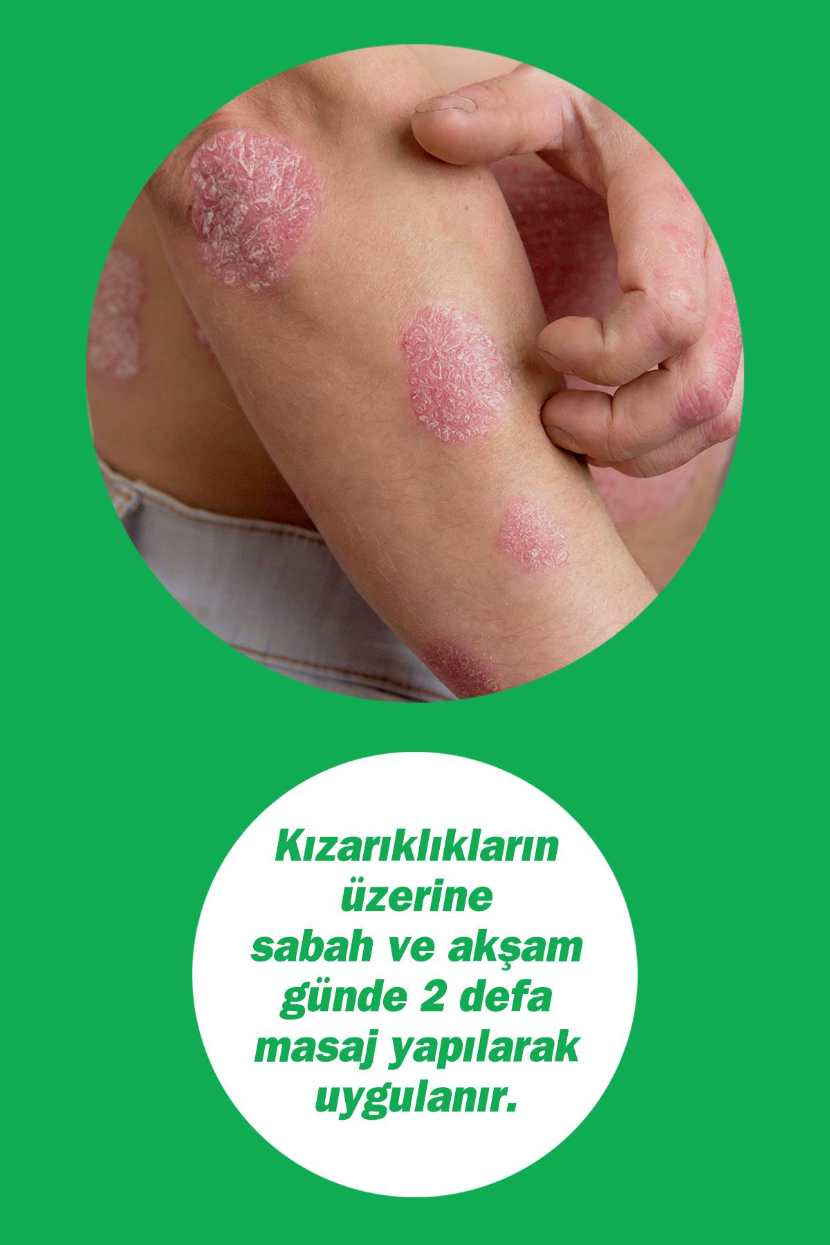 کرم بدن DERMODICOS 30 میل هیالورونیک روغن درخت چای Tto