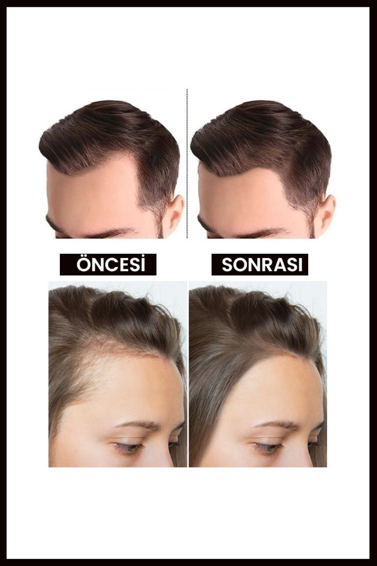 Luis Bien-Rosemary Oil anD Black Garlic Oil - Hair Loss anD Nourishing 7