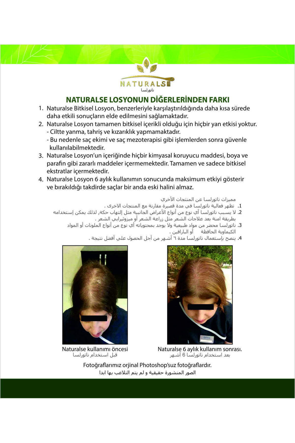 Dökülme Karşıtı Bakım Serumu – Hair Care Serum – Saç Dökülmesine Karşı Losyon Sprey Serum 100 ml — Naturalse100ml — تصویر 3 از 8