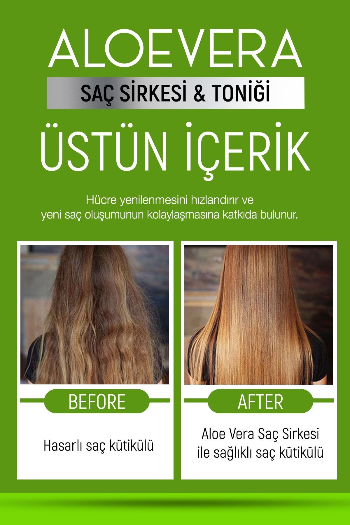 Aloe Vera Özlü Saç Sirkesi & Saç Toniği 400 Ml - Kepek Ve Dökülme Karşıtı - Hızlı Uzama Etkili — SR — تصویر 6 از 6