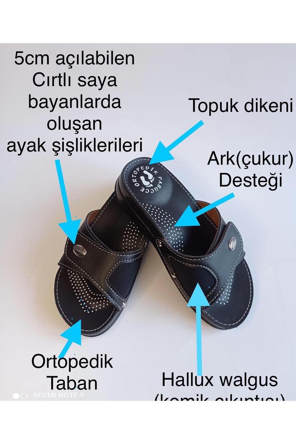 Anatomik Hallux Valgus Kemik Çıkıntısı Topuk Dikeni Terlik