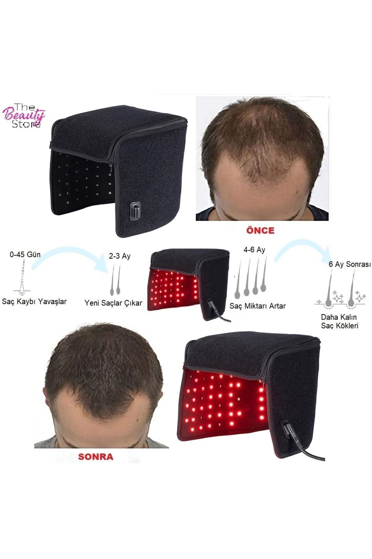 دستگاه ترمیم، جوانسازی و سفت کننده موی صورت، رفع چین و چروک، آکنه و جای زخم، ماسک زیبایی پوست — قرمز HAIR3 — تصویر 7 از 9