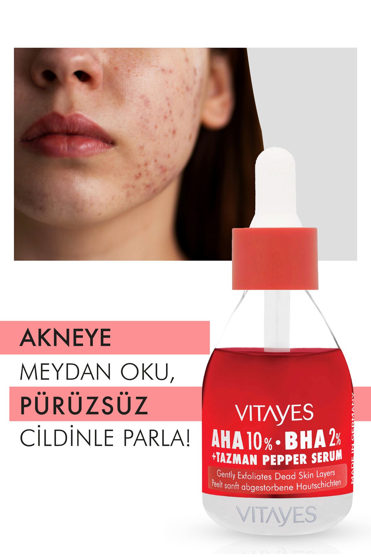 VITAYES-Red Peeling - Skin Tone Equalizing Acne Serum 10% Bha 2% 2