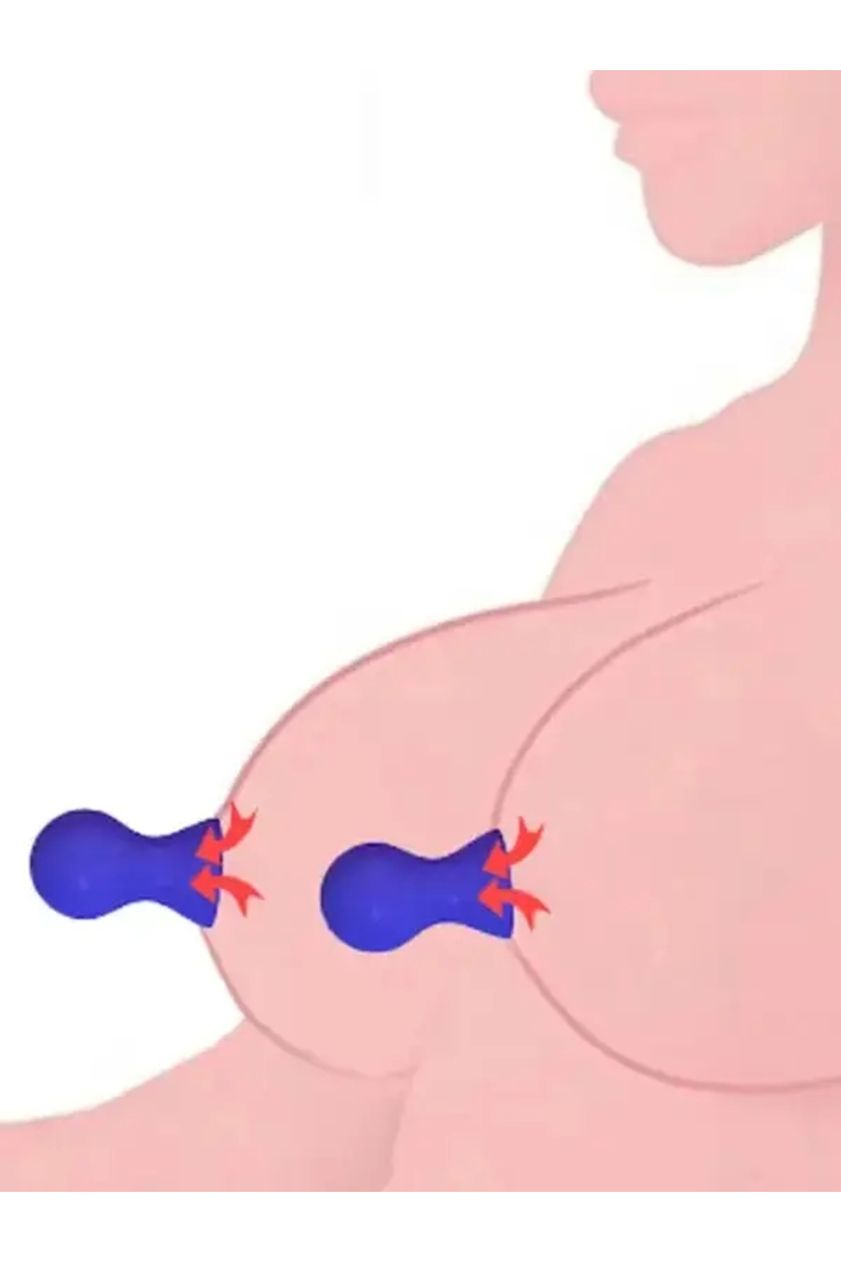 NOXXX Nipple Suckers Göğüc Ucu ve Klitoris Pompası Mor fotoğrafı 2 (önizleme)