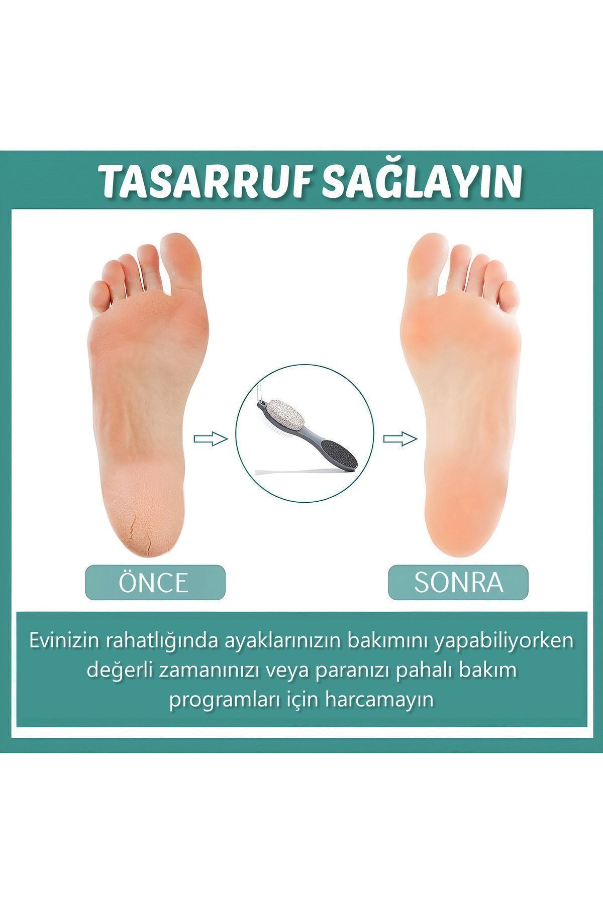 KaktüsKedi-4 Functional Heel File Foot Care Set| 4 in 1 Set 6