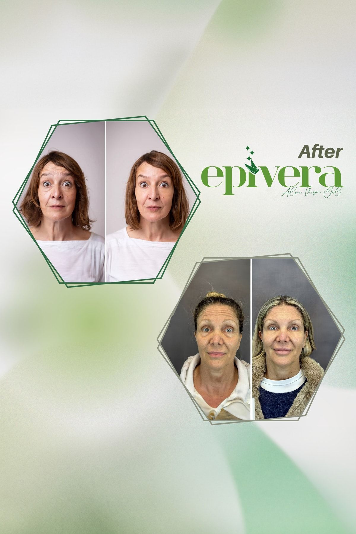 EPİVERA-Aloe Vera Extract - Anti-aging Moisturizing Face Cream, Anti Wrinkle 5