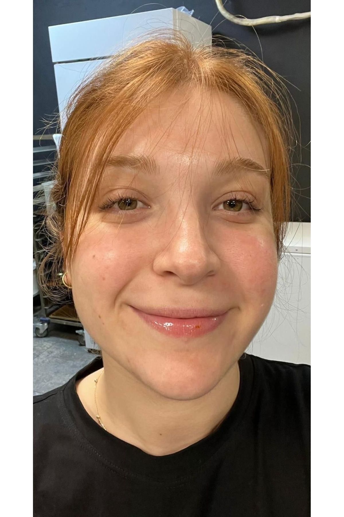 سرم پوست   Oxo Global | oxo اورجینال - تصویر 4