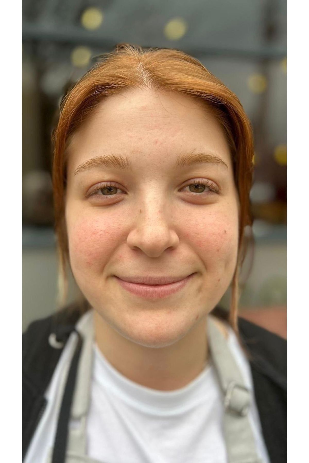 سرم پوست   Oxo Global | oxo اورجینال - تصویر 3