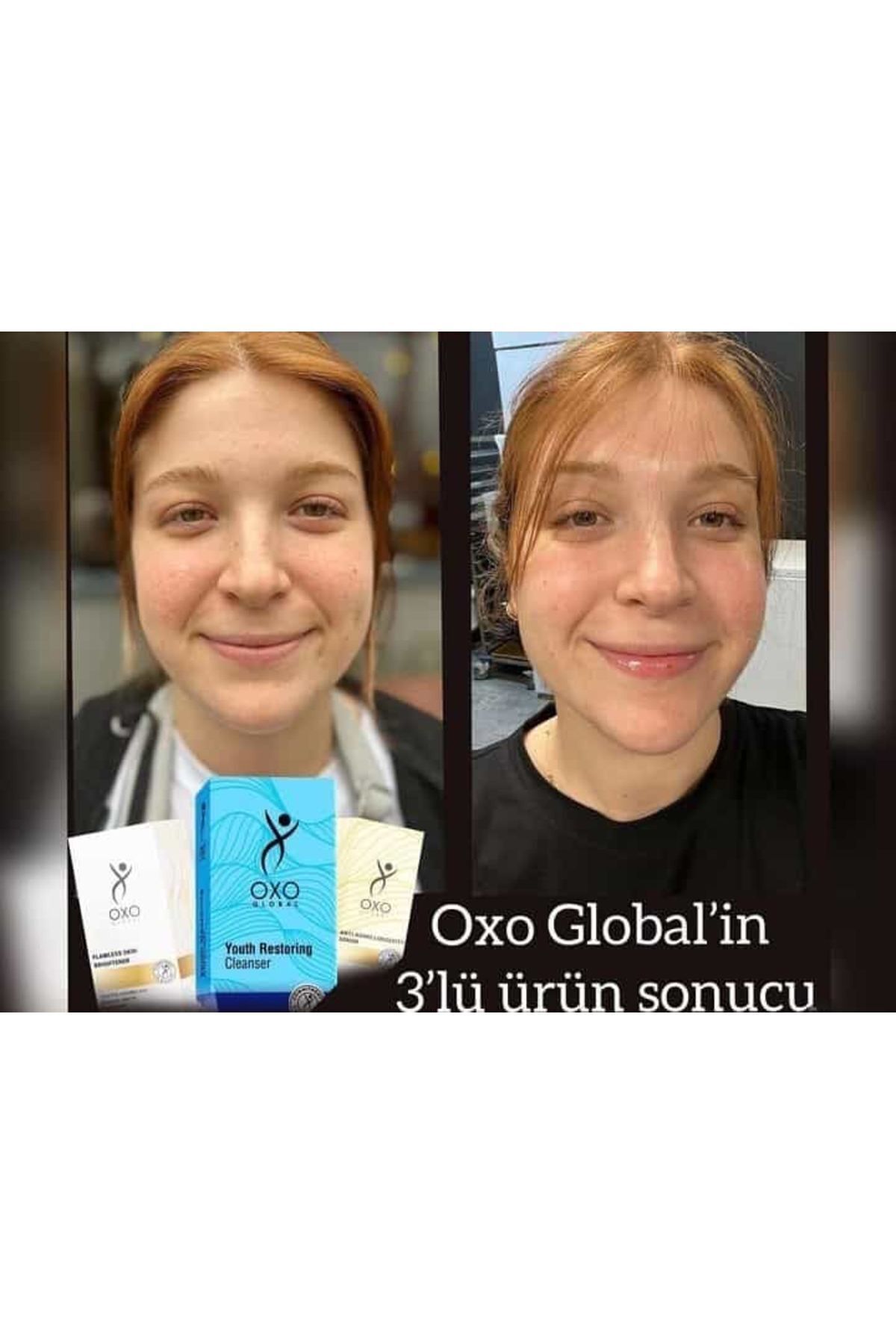 سرم پوست   Oxo Global | oxo اورجینال - تصویر 2