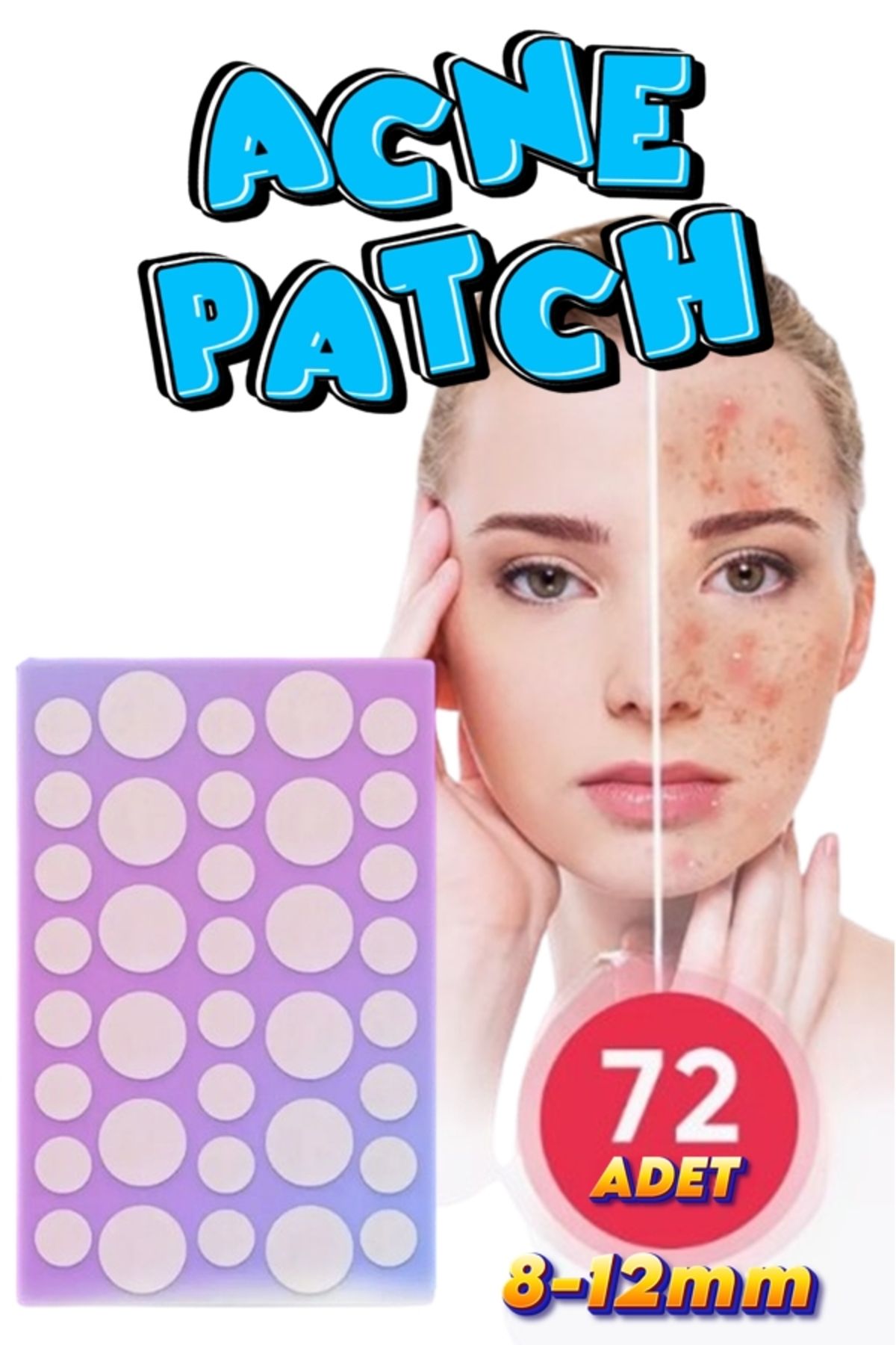 xolo Band Acil Durum Bandı 72 Adet Akne Sivilce Bandı Acne Patch XL72