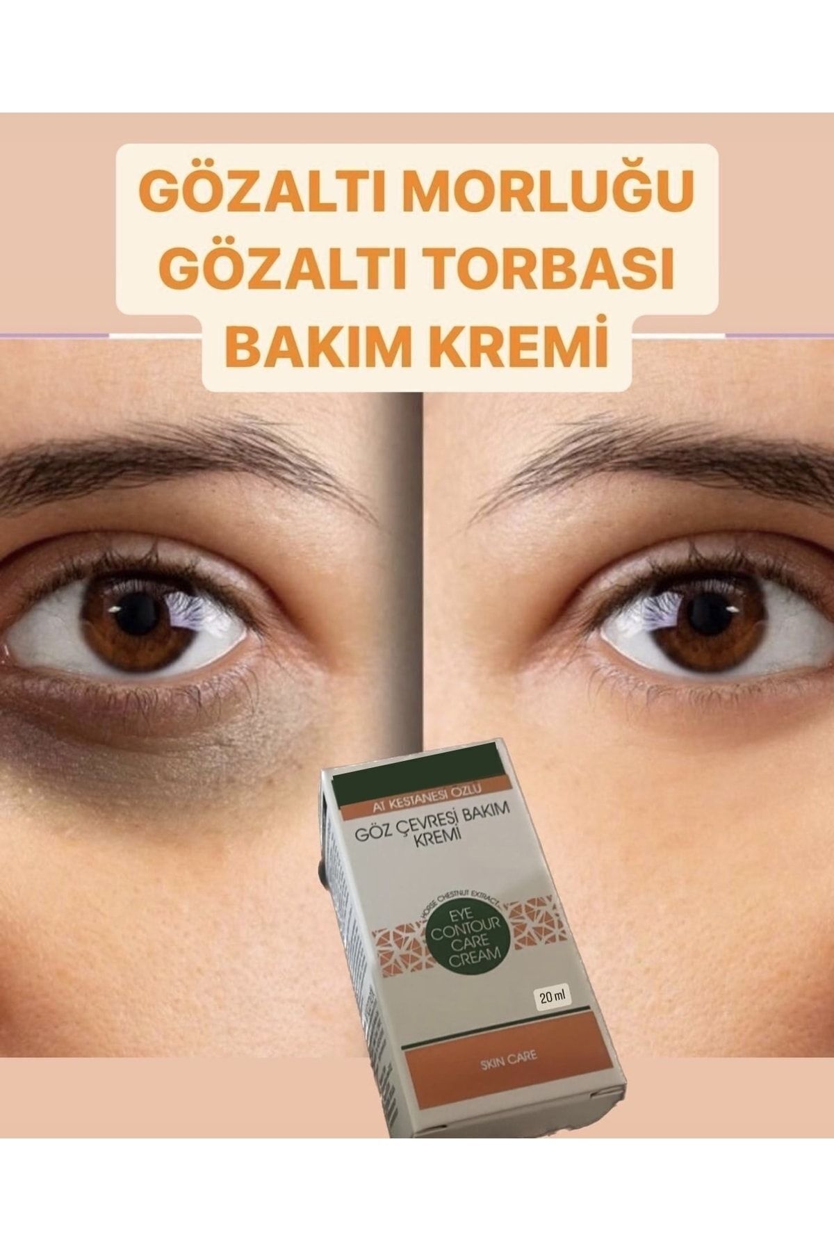 akiska-Dr. Dermo Care Cream with Horse Chestnut Extract - Under-Eye Bag - for Dark Circles and Dark Circles 20 ml 2