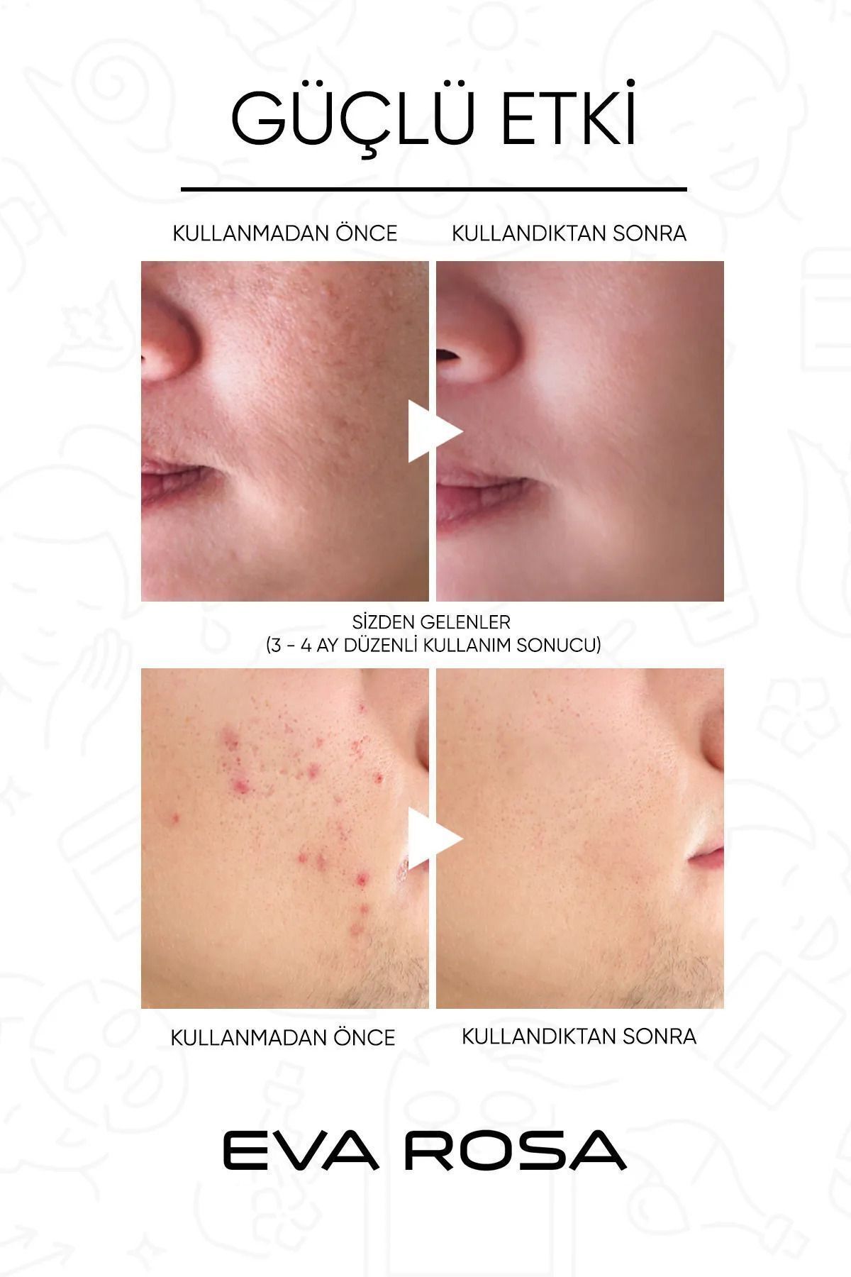 Siyah Nokta Ve Sivilce Karşıtı Yüz Temizleme Jeli 250 ml (SEBUM ORANINI DENGELER) — yüztemizlemejeliyeşil — تصویر 6 از 7