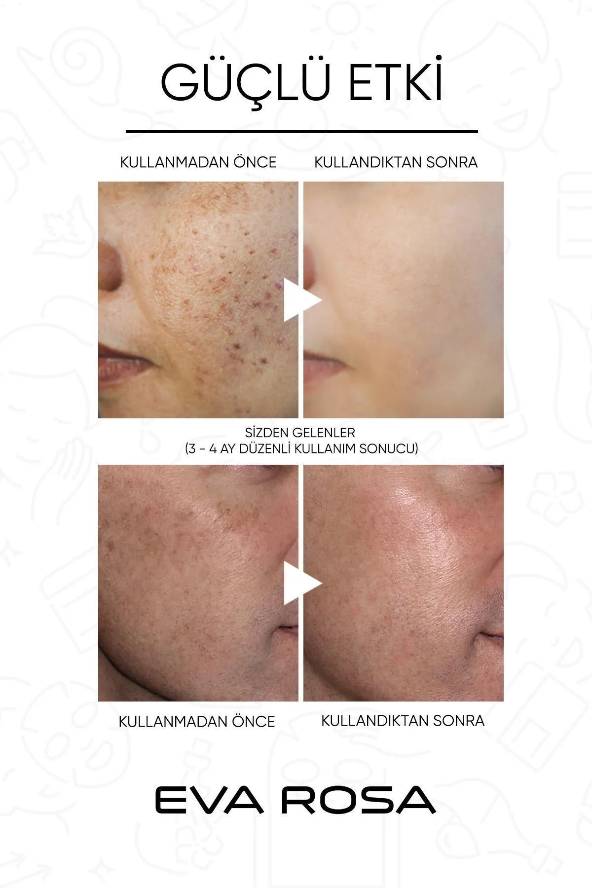 Aha & Bha Canlandırıcı & Cilt Tonu Eşitleyici Kırmızı Peeling Cilt Serumu 30 ml — kırmızıserum — تصویر 6 از 7