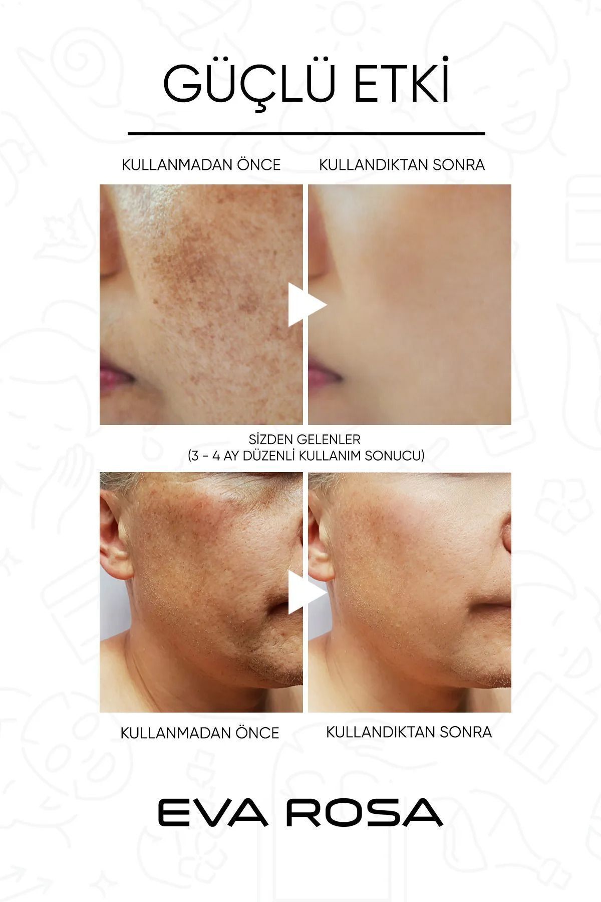 سرم پوست   Eva Rosa | darkspotserum اورجینال - تصویر 6