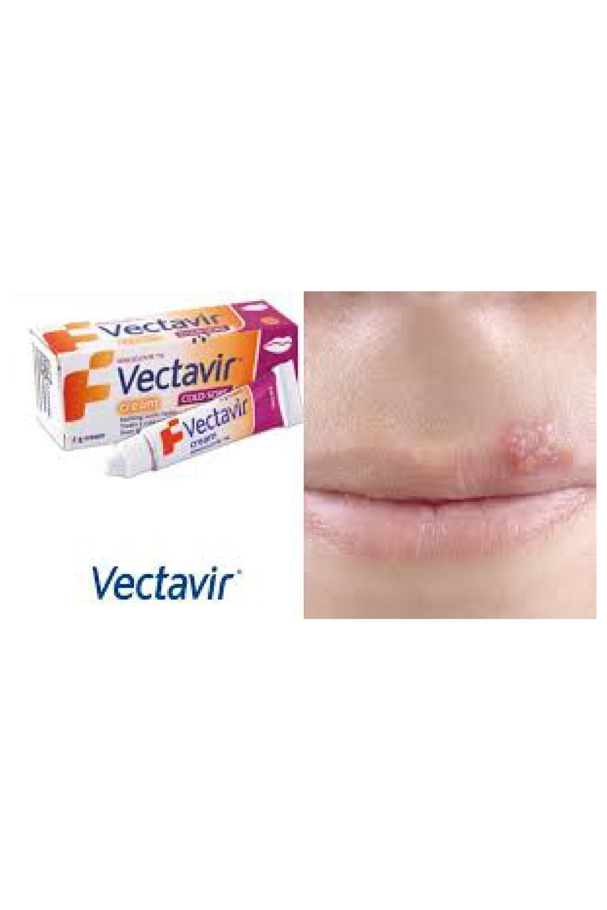 Bepanthen-vectaVir 1% Cream 2gr - Definitive ResUlt for Herpes and Herpes VirUses 2