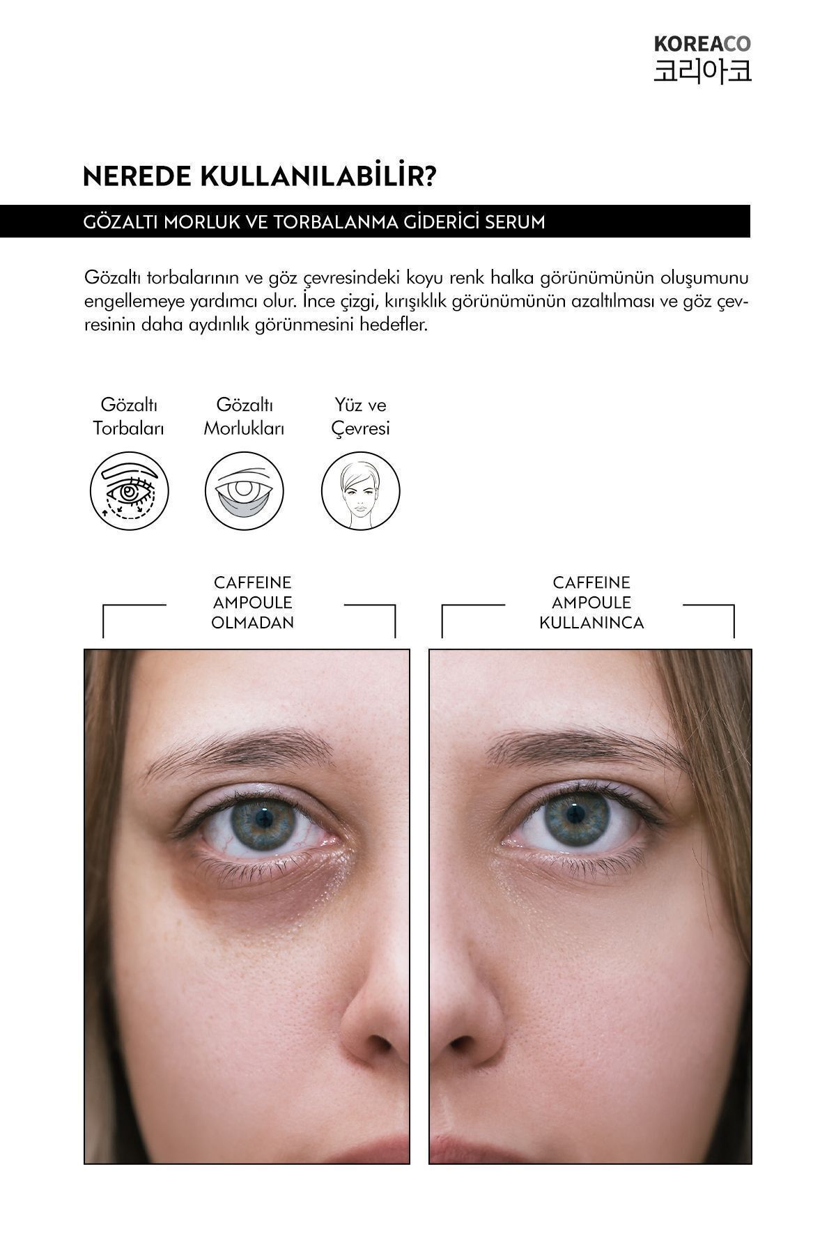 Gözaltı Morluk,Koyu Halka ve Torbalanma Karşıtı Caffeine Ampoule Serum 50 ml — TYC1TKCK0N169273688650259 — تصویر 4 از 6
