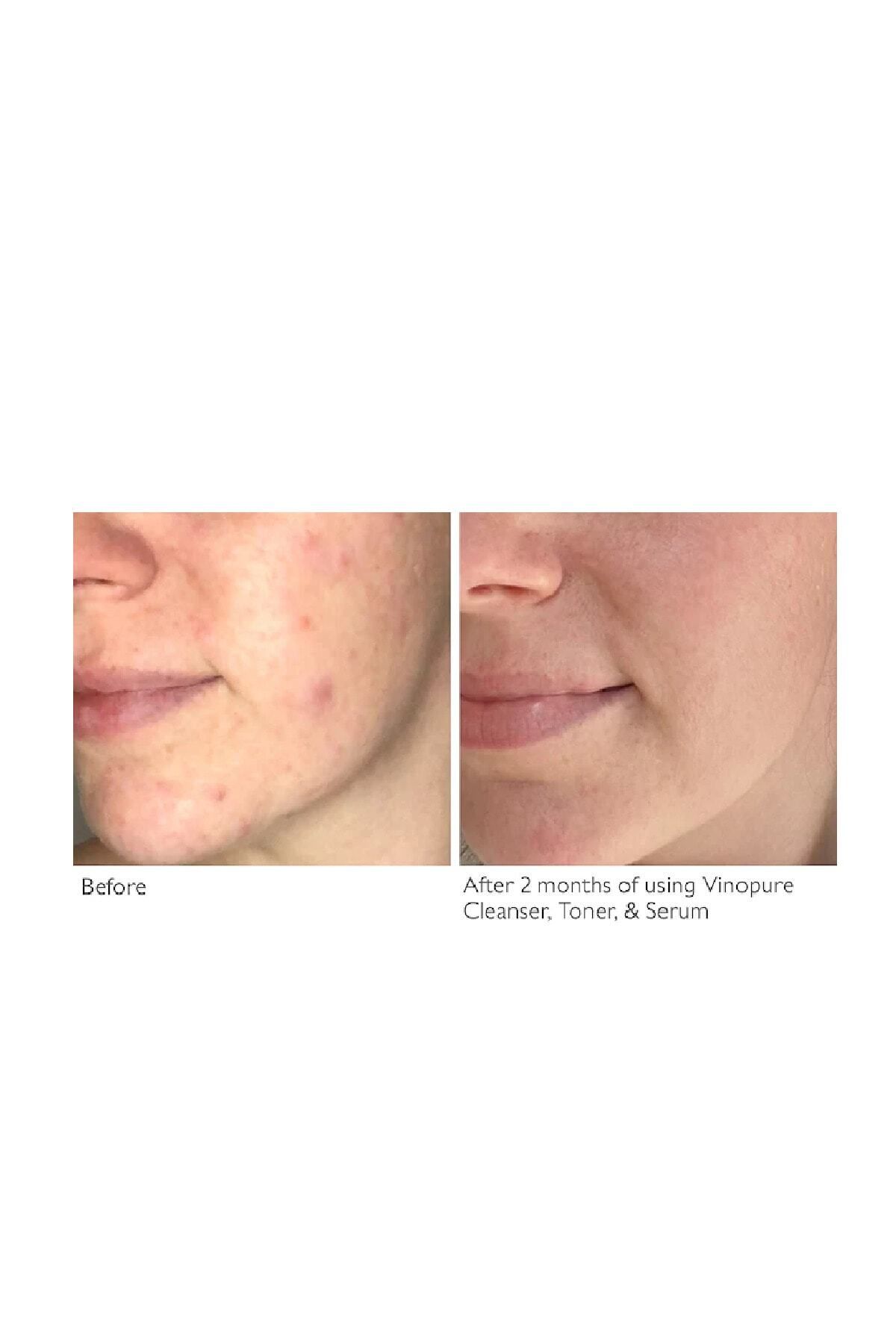 سرم پوست   کدلیCaudalie | Passi.1787 اورجینال - تصویر 4