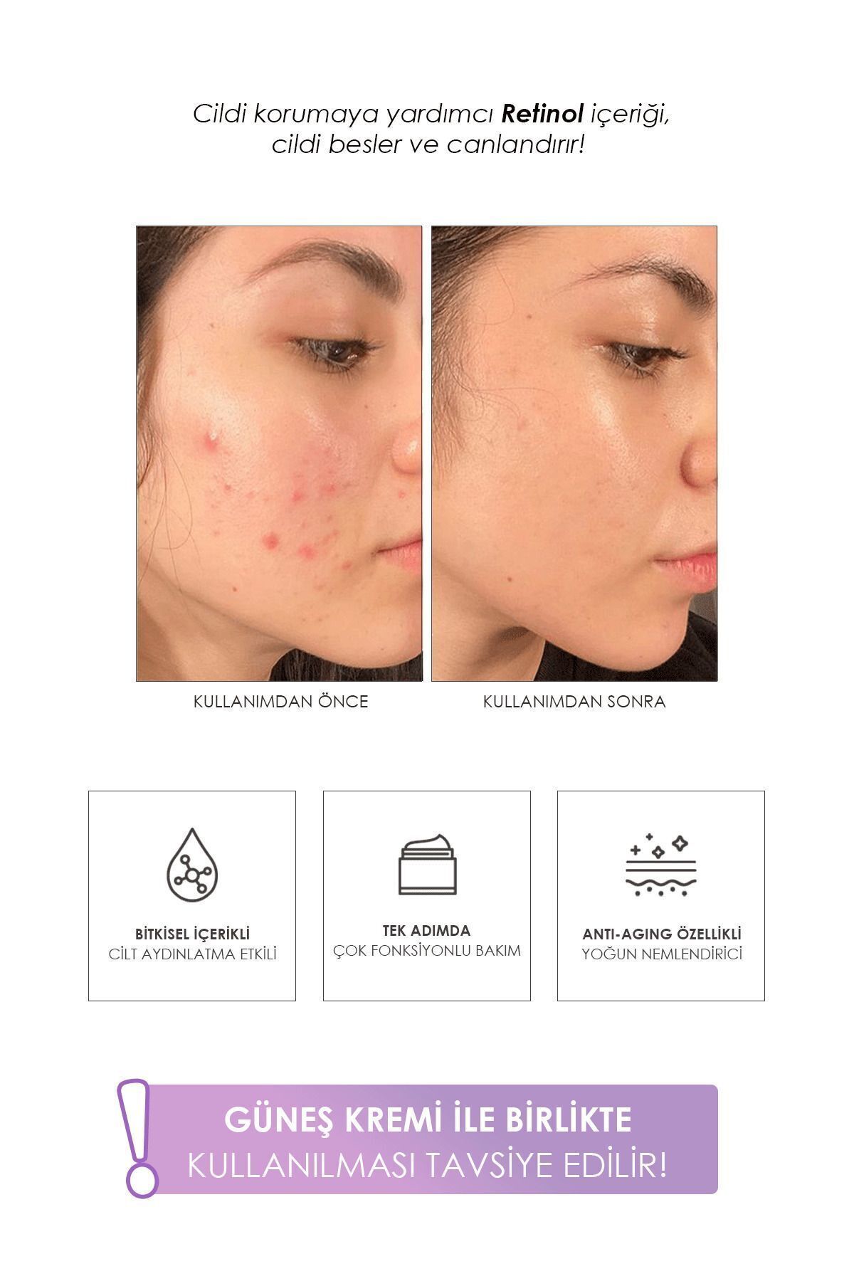 کرم صورت   PRETTYSKIN | TYC5HMHLYN169710502915102 اورجینال - تصویر 5