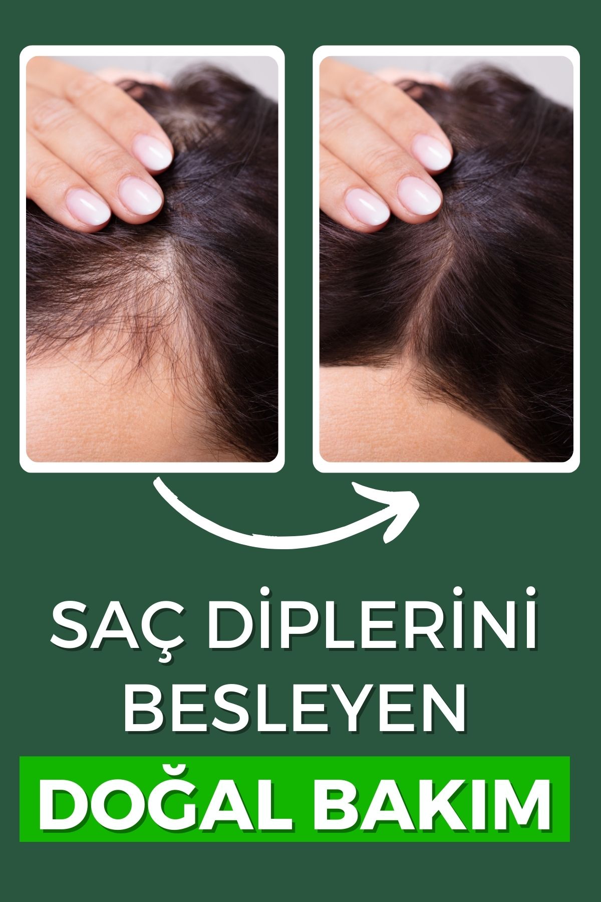 2'li Saç Bakım Yağları Biberiye Yağı 50 ml, Hint Yağı 50 ml — NEV00001BIHI — تصویر 5 از 7