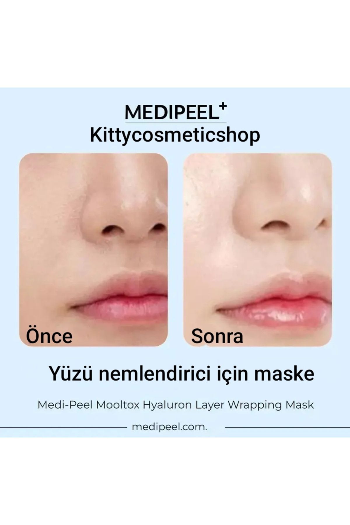 Medipeel-Mooltox Hyaluron Layer Wrapping Mask(Mask for Moisturizing Face) 4