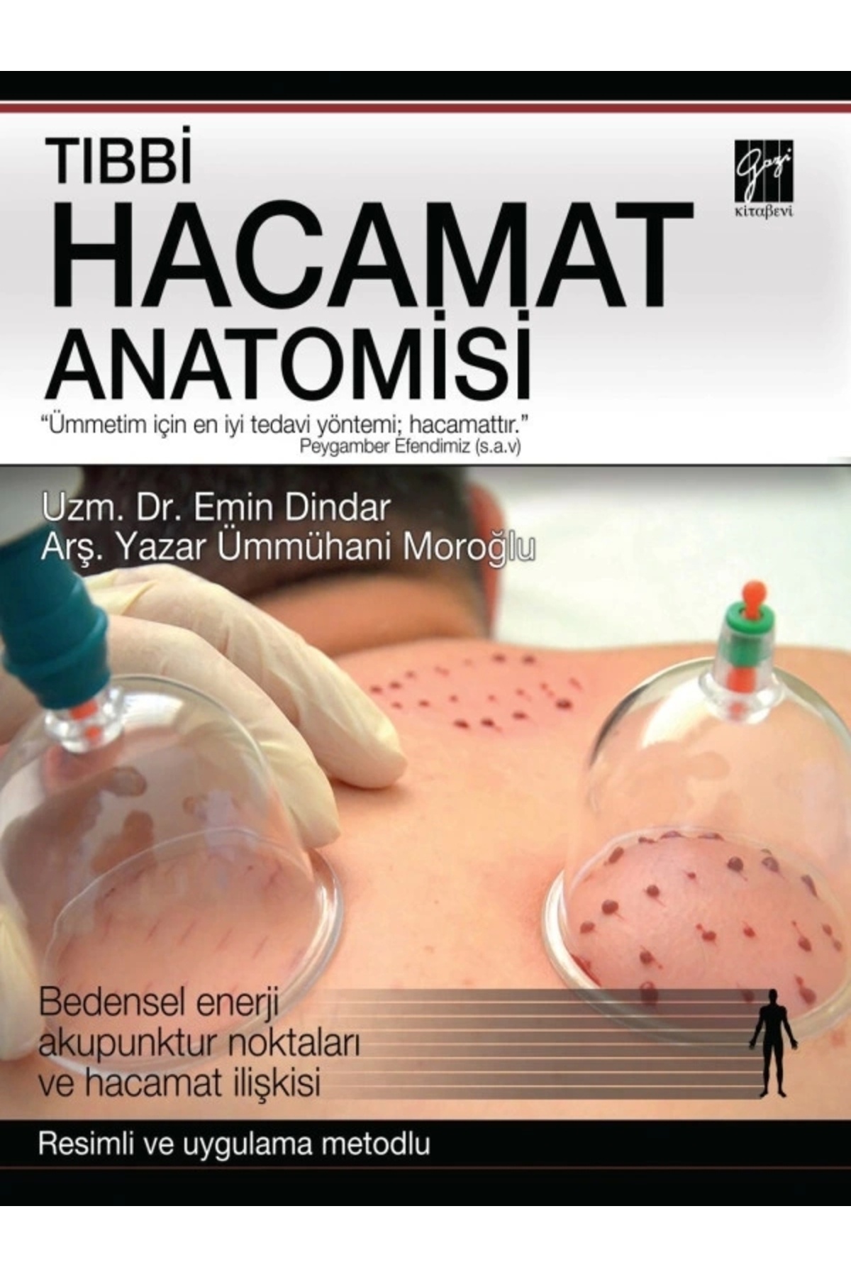 Gazi Kitabevi Tıbbi Hacamat Anatomisi - Emin Dindar,ümmühani Moroğlu
