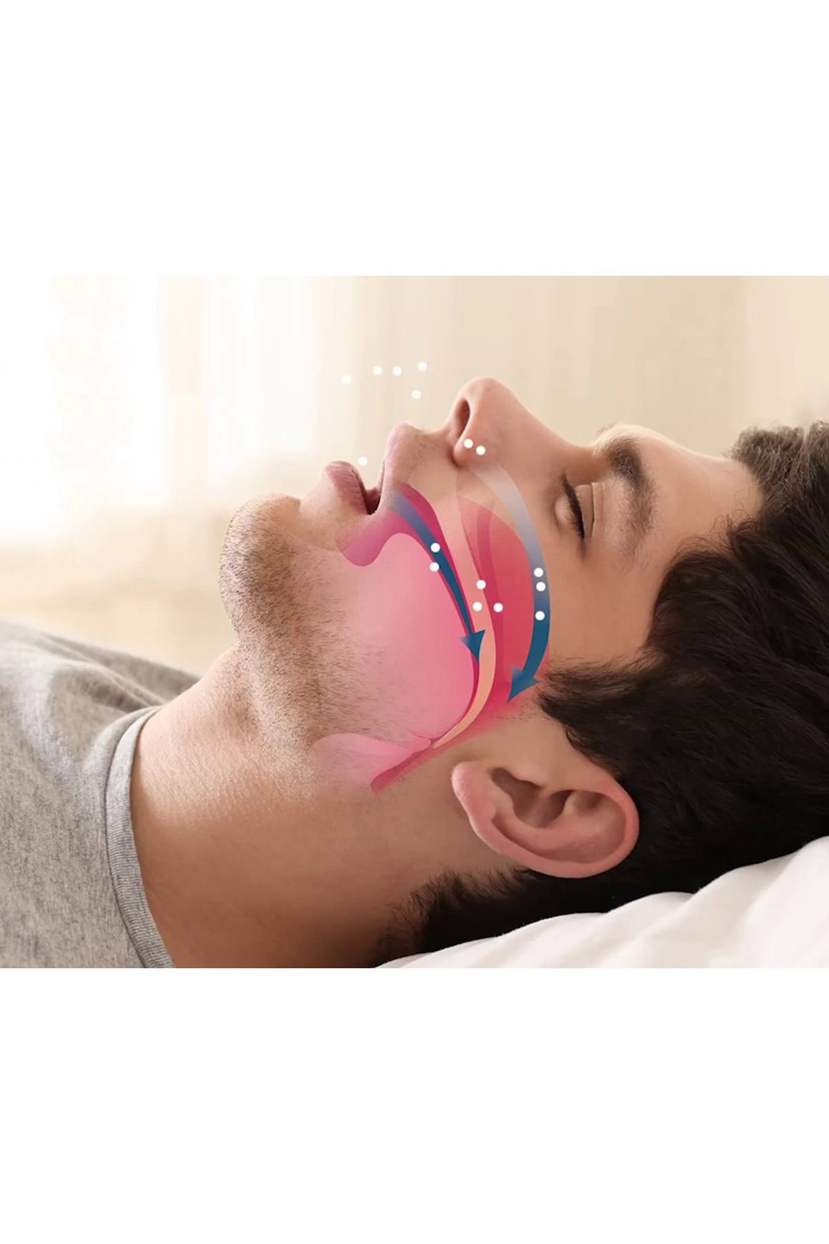 Epilons Rahat Uyku İçin Anti Snore Sleep Horlama Engelleyici Aparat Uyku Stoperi fotoğrafı 3 (önizleme)