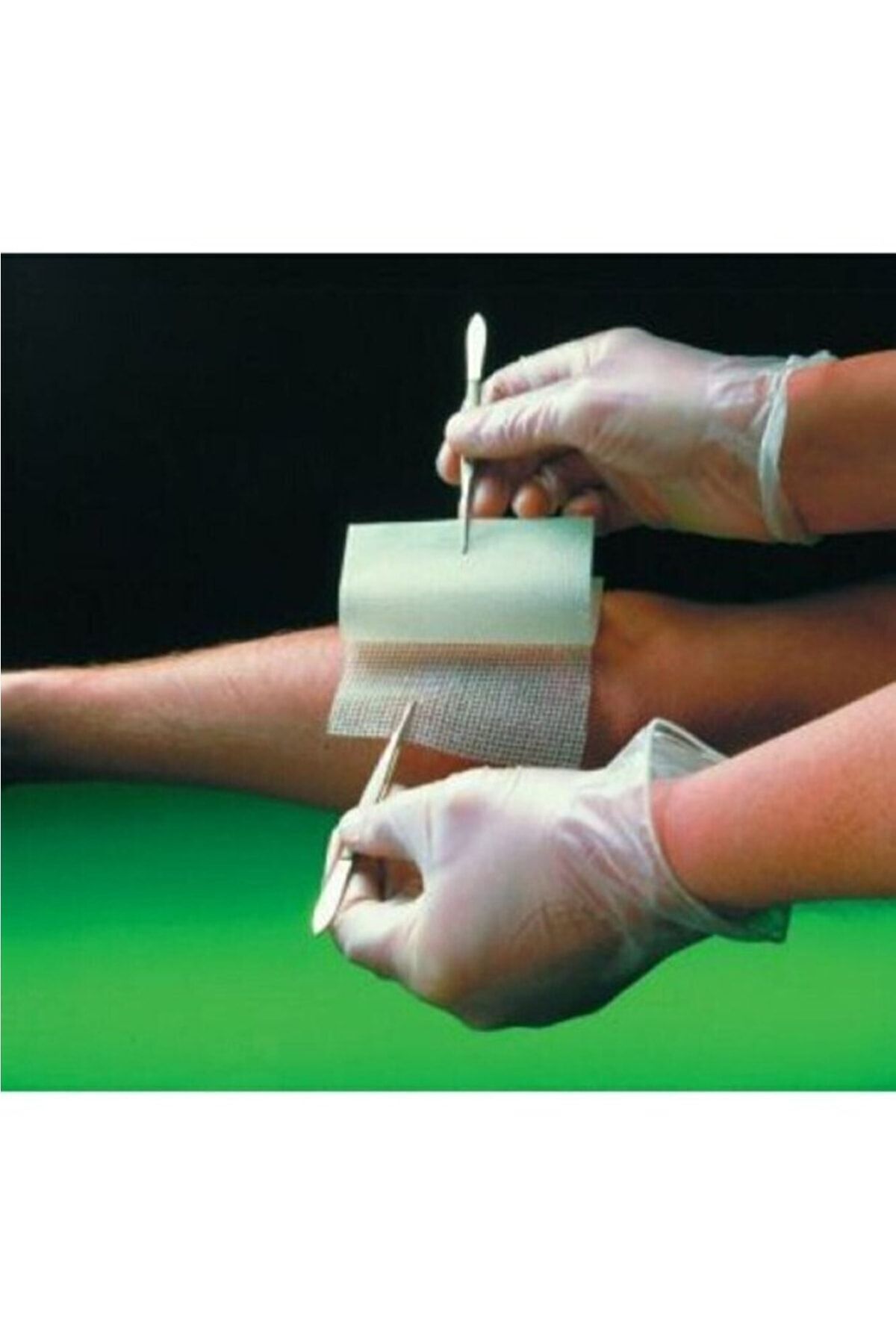 bactigras-Paraffin Antiseptic Tulle Wrap Wound Care Cover 15cm X 20cm 10 Pieces 2