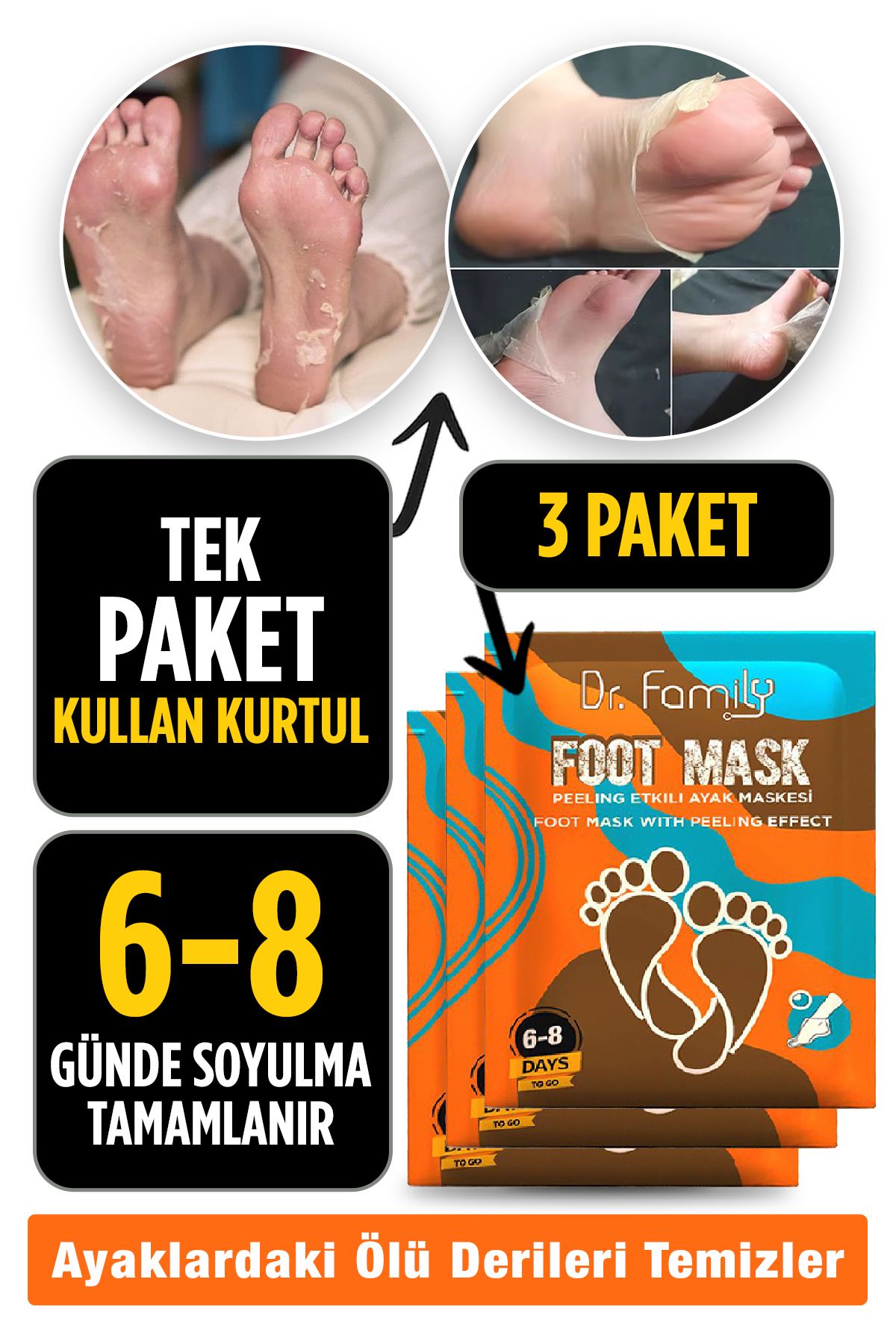 Dr Family Ayak Peeling Maskesi - Soyulabilir Ölü Deri Soyucu Ayak Bakımı Kokuyu Giderir Ve Nasırları Atar - X3