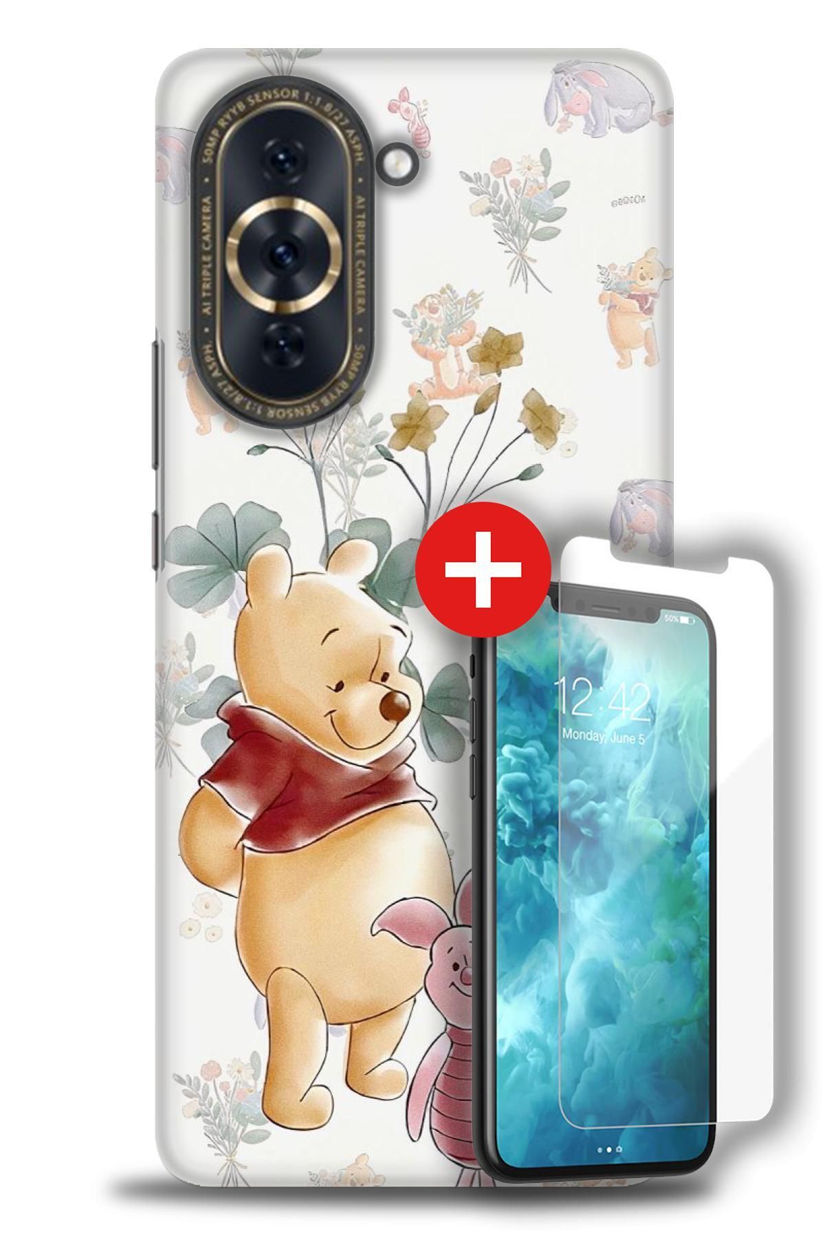 kılıfevreni Huawei Nova 10 Kılıf HD Baskılı Kılıf + MAT DAVİN KIRILMAZ EKRAN KORUYUCU n (111)