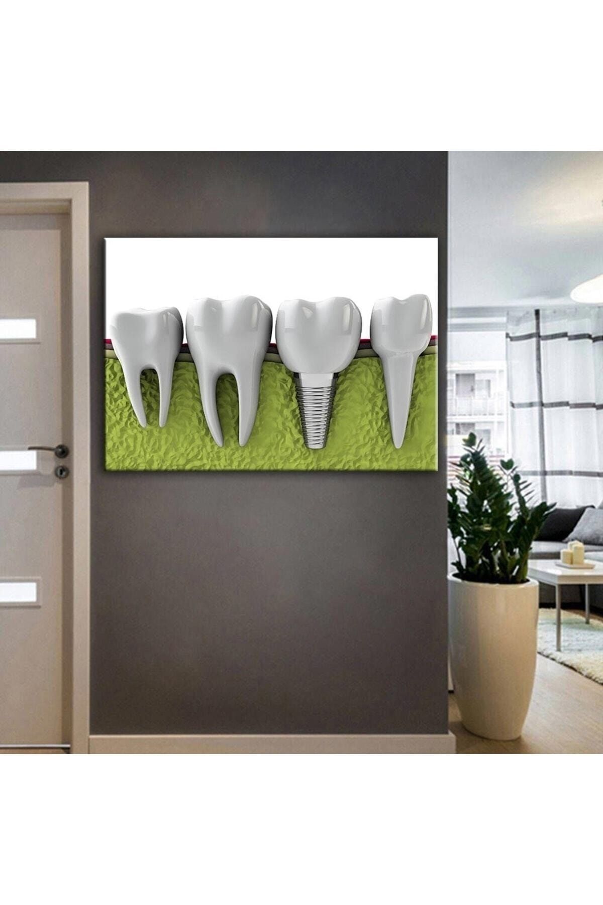 Vividale Ağız Ve Diş Sağlığı Polikliniği Tabloları Dekoratif Diş, Dekoratif Dişçi, Dişçi Dekorasyonu Dsc-33